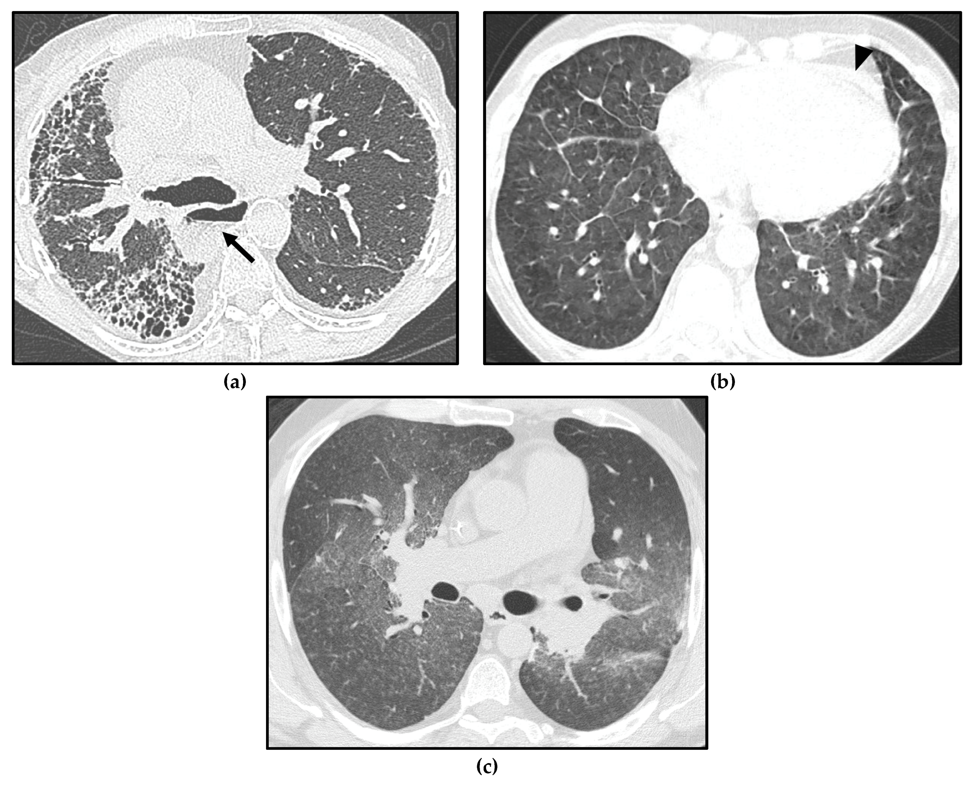 Diagnostics 13 01607 g005