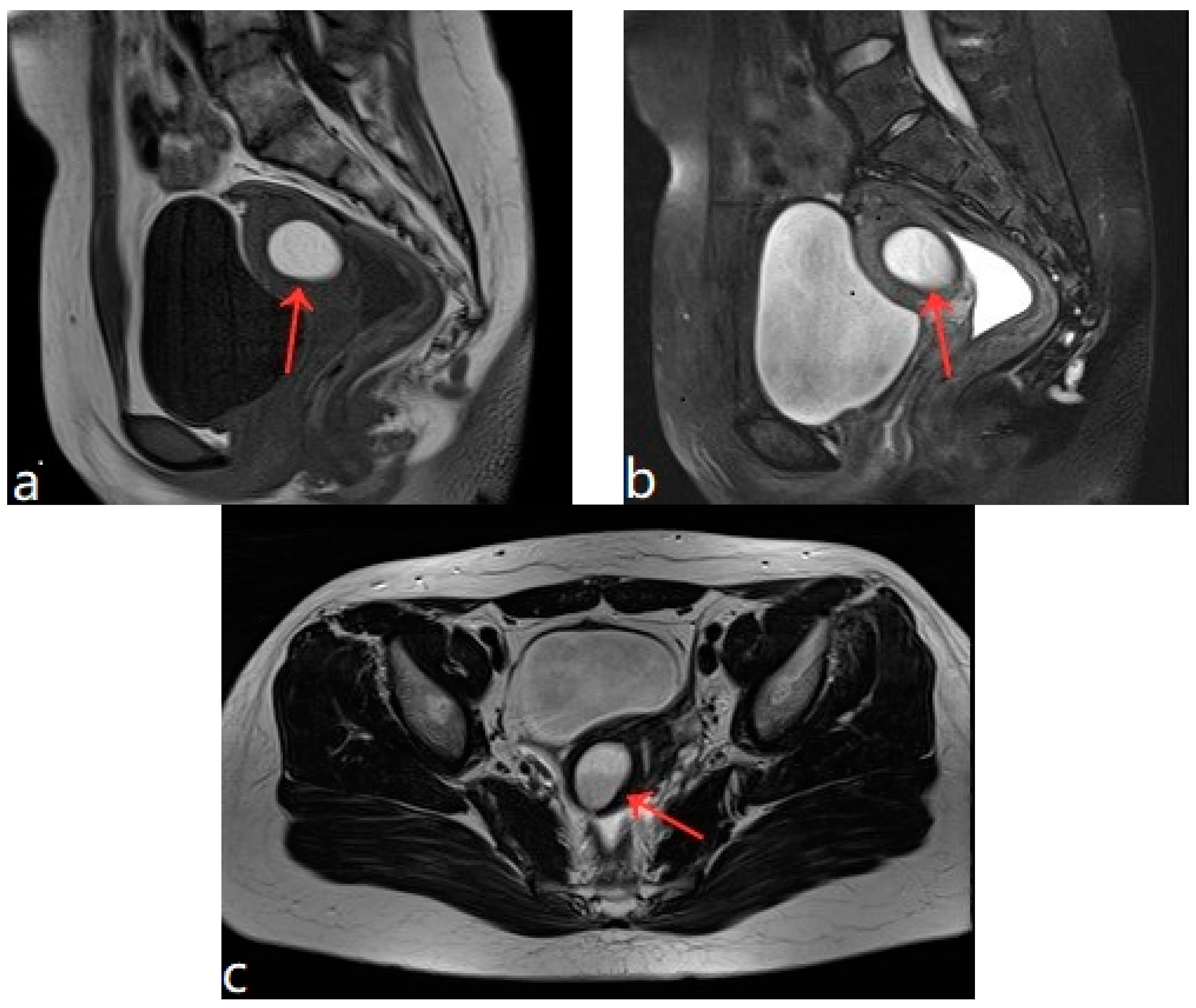 Diagnostics 13 01608 g001