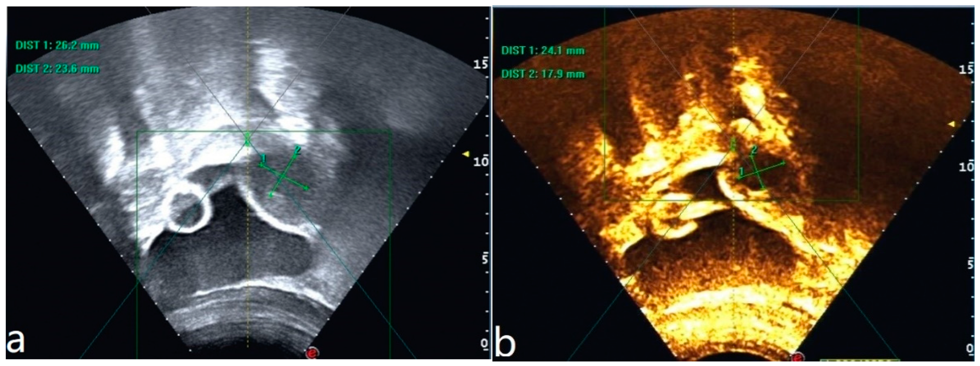 Diagnostics 13 01608 g002
