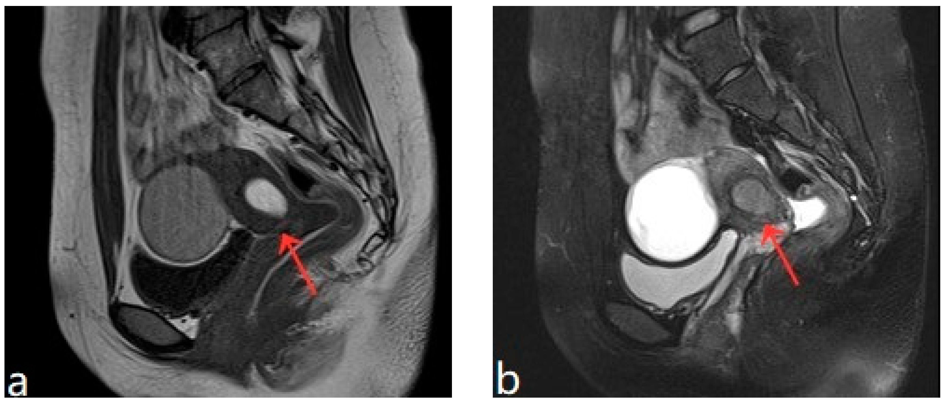 Diagnostics 13 01608 g003