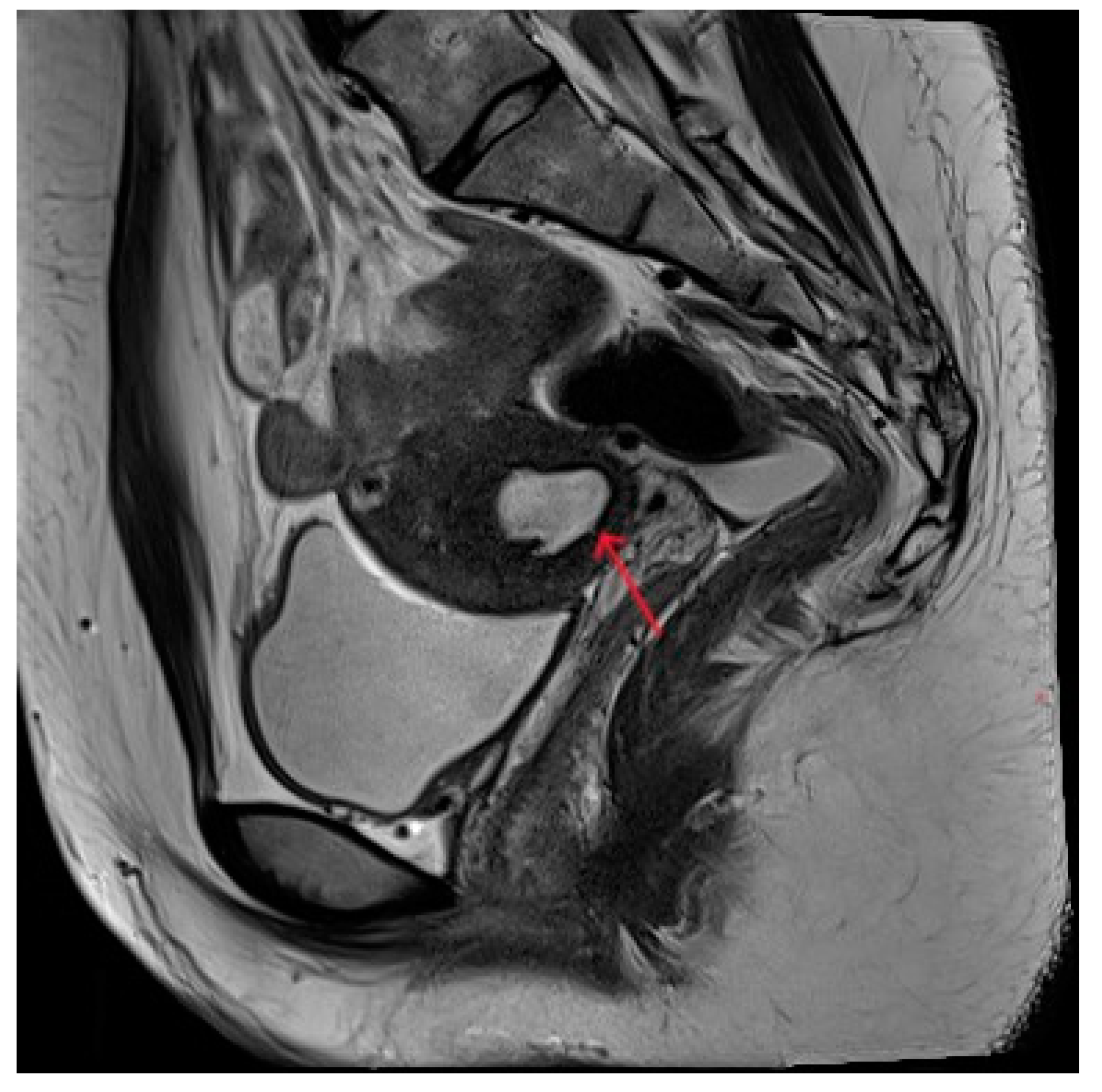 Diagnostics 13 01608 g004
