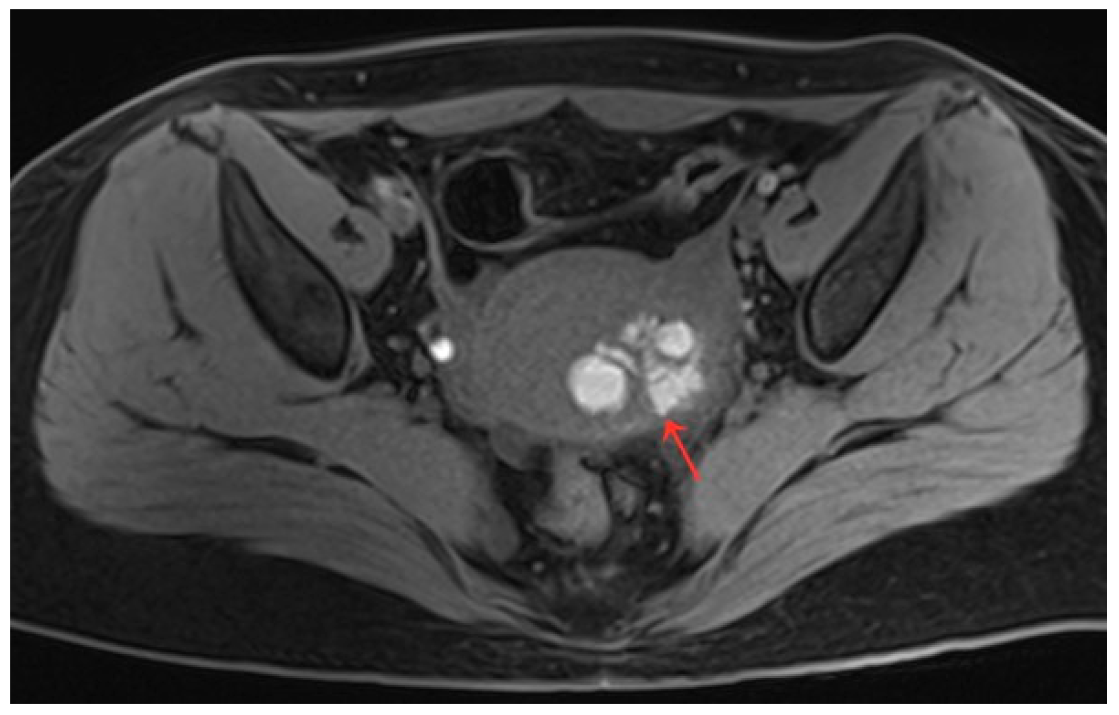 Diagnostics 13 01608 g005