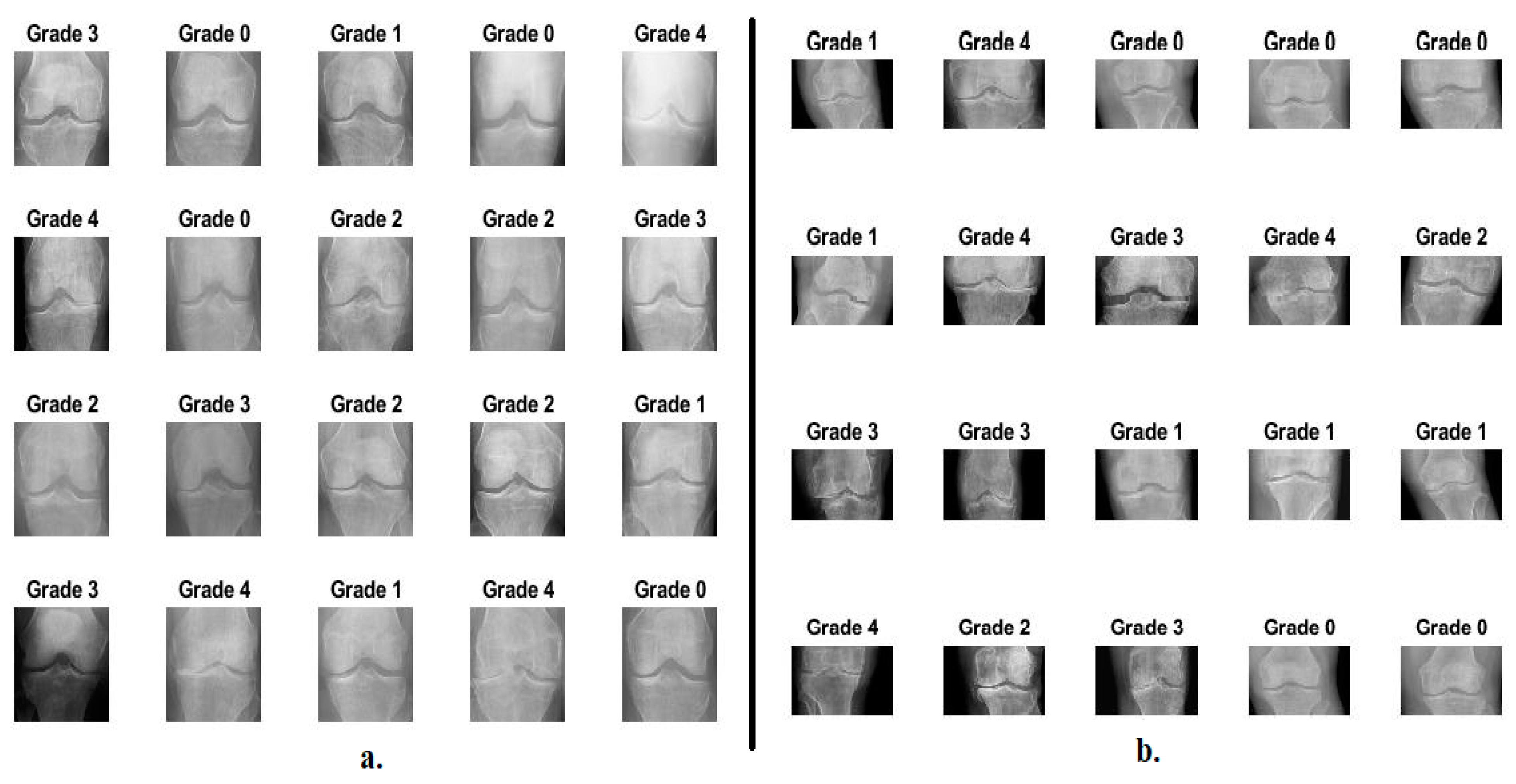 Diagnostics 13 01609 g002