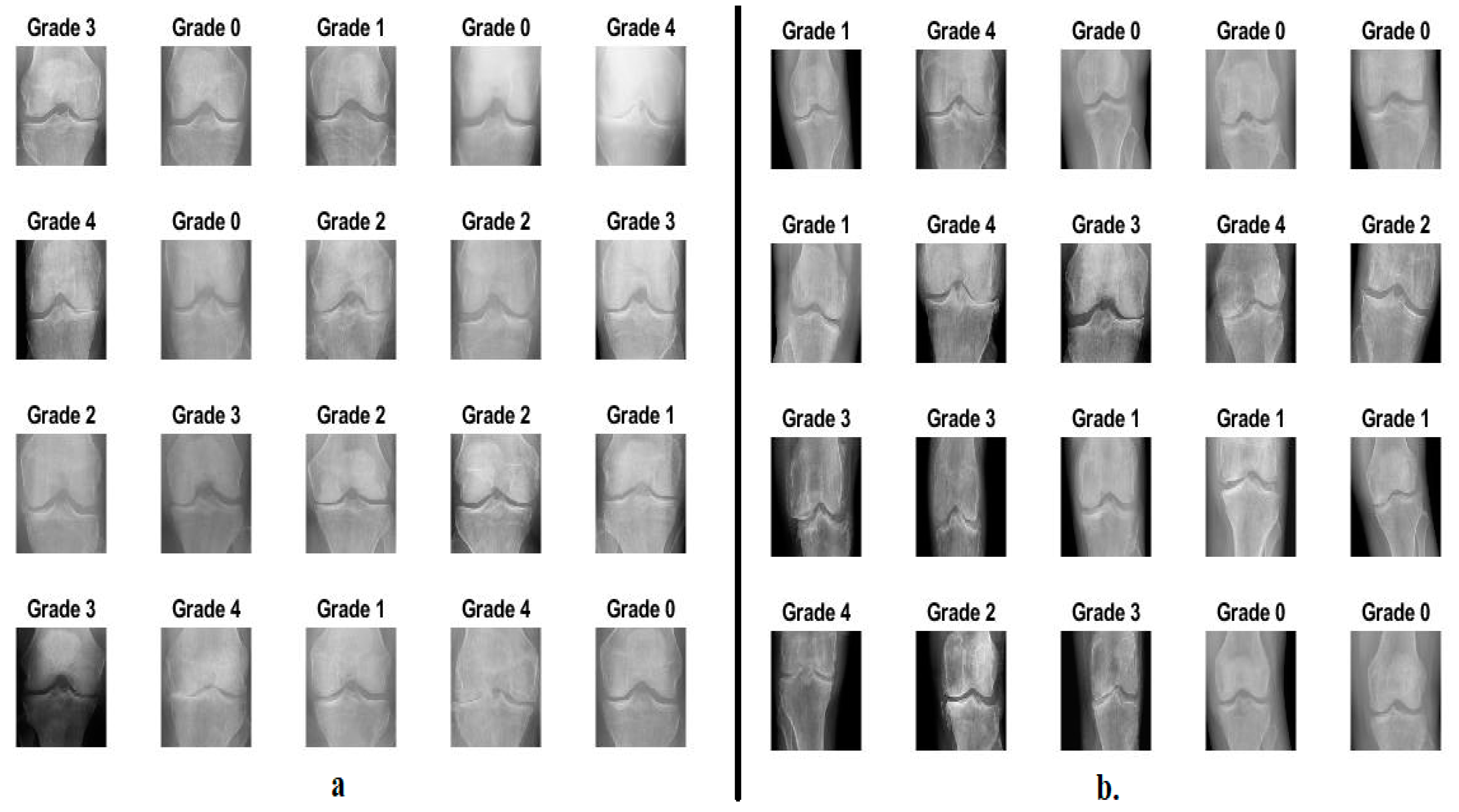 Diagnostics 13 01609 g003