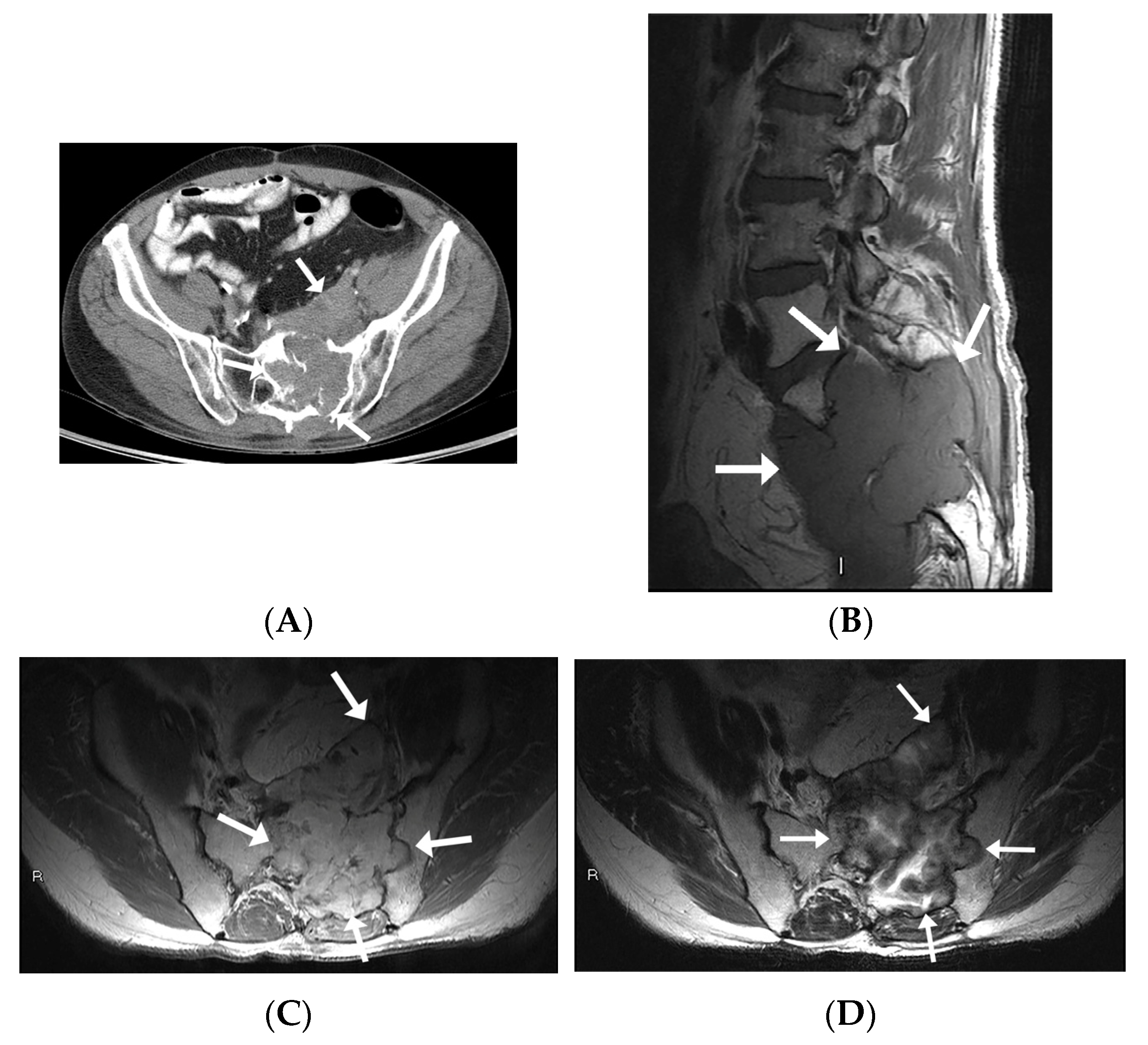 Diagnostics 13 01610 g003