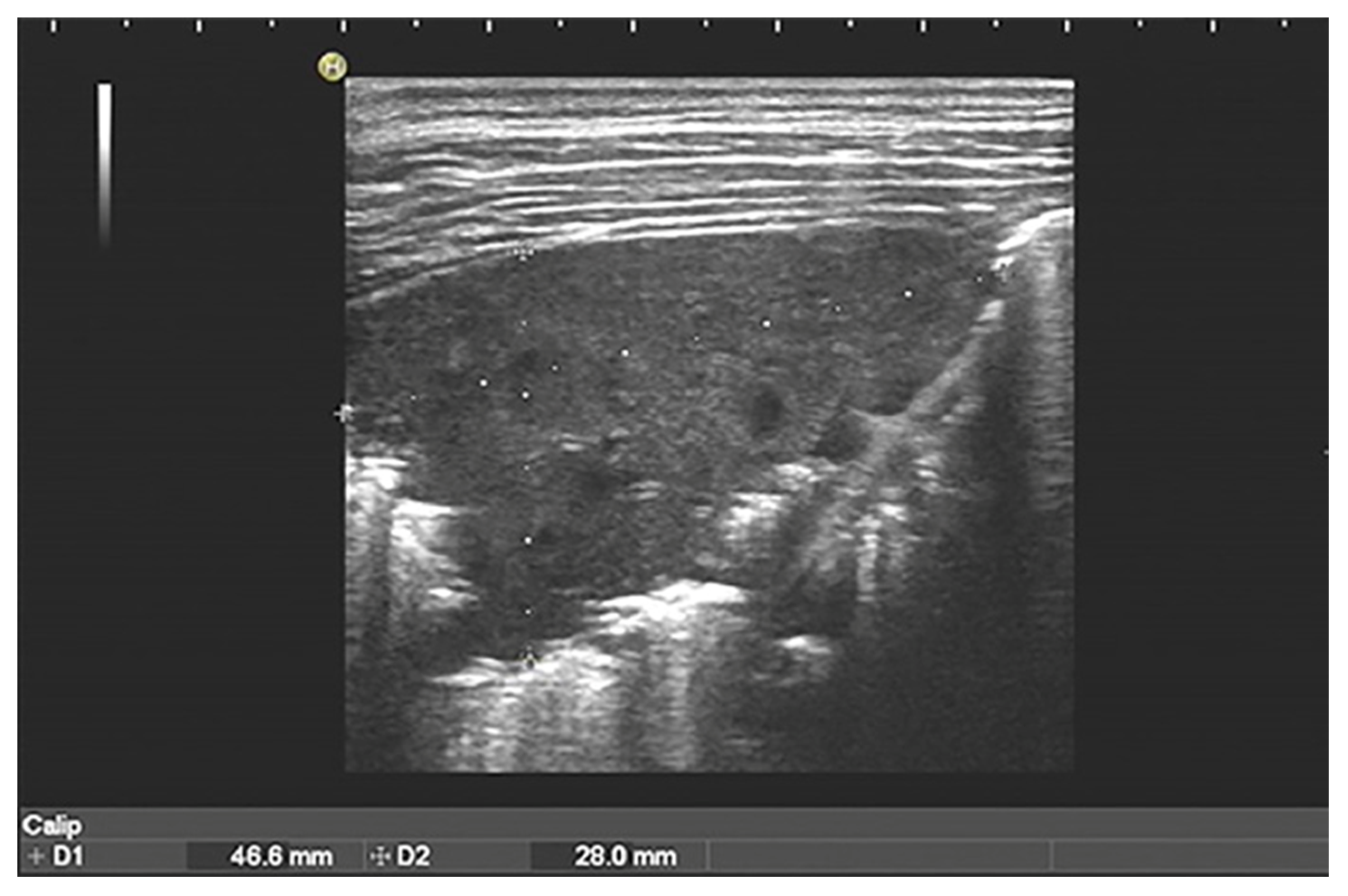 Diagnostics 13 01612 g002