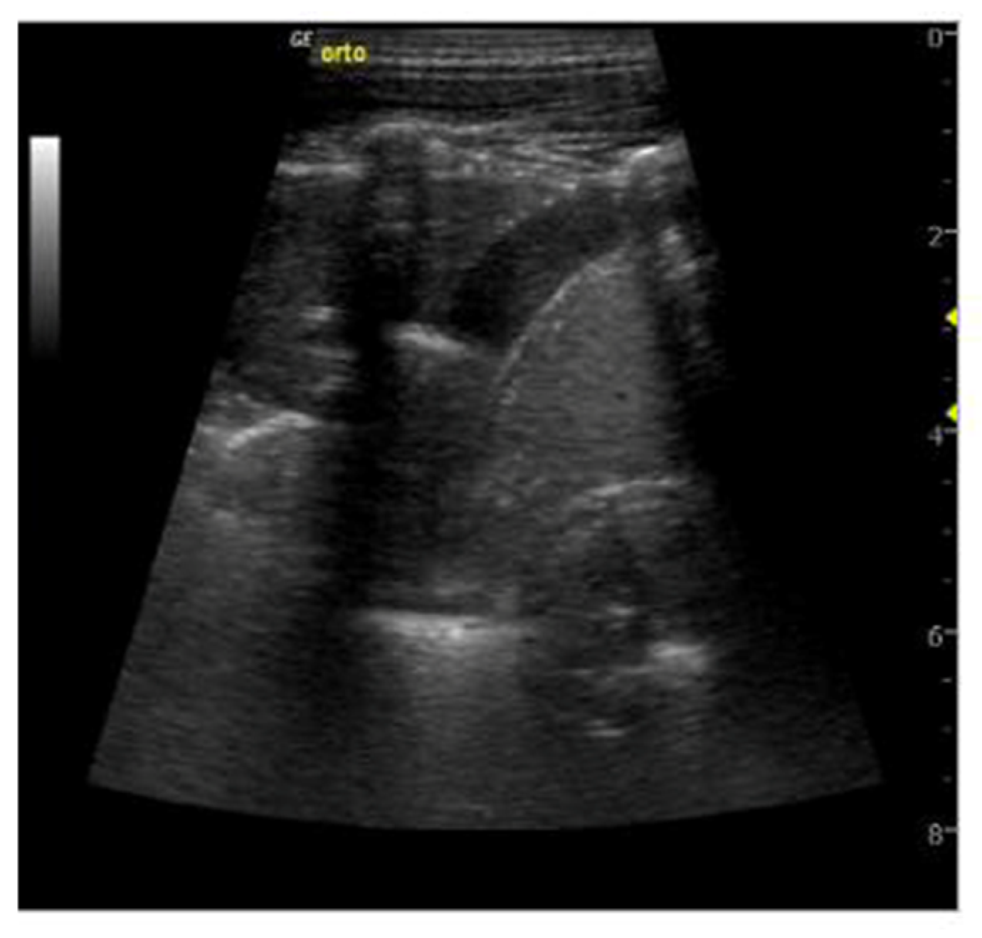Diagnostics 13 01612 g003