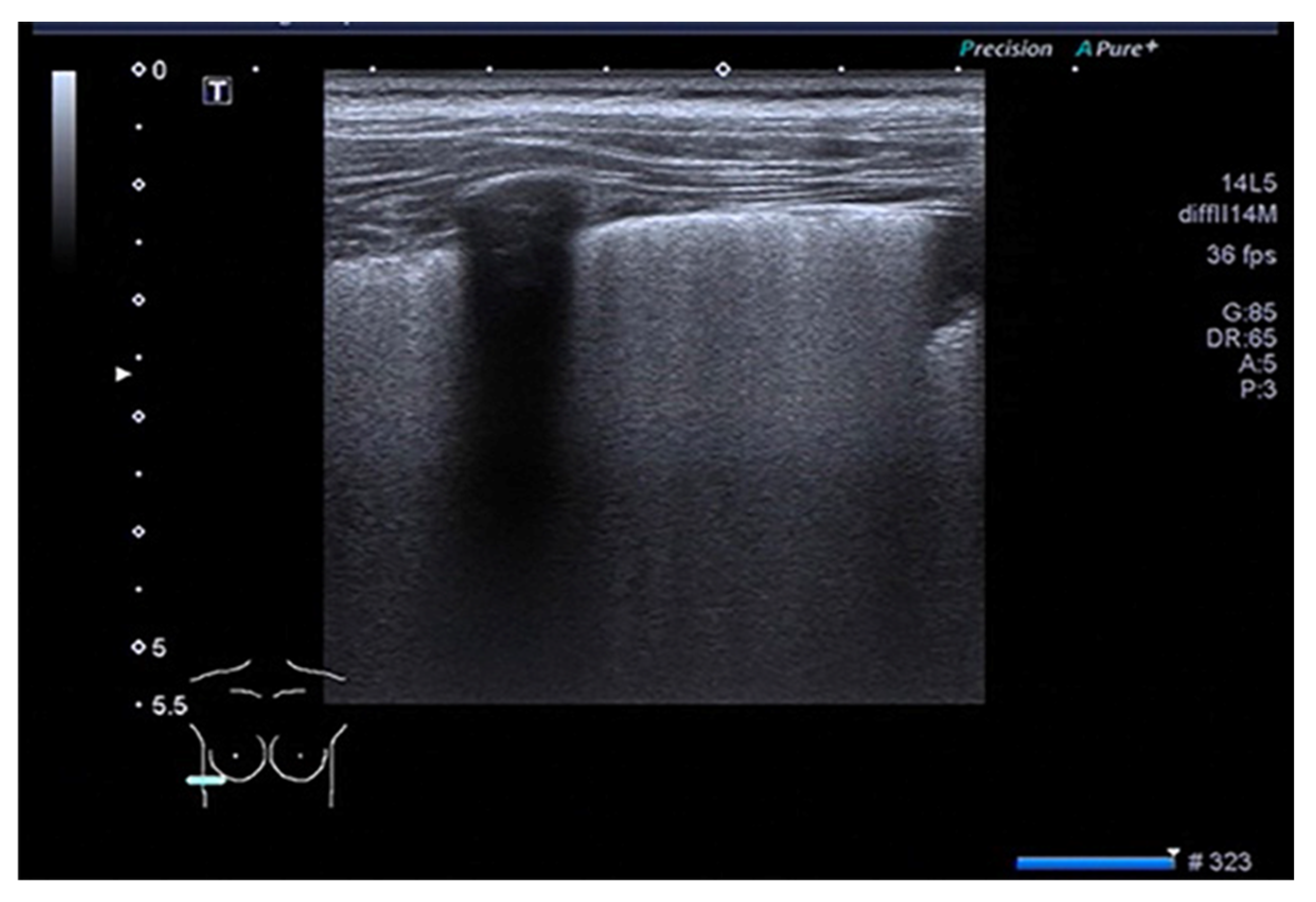 Diagnostics 13 01612 g004