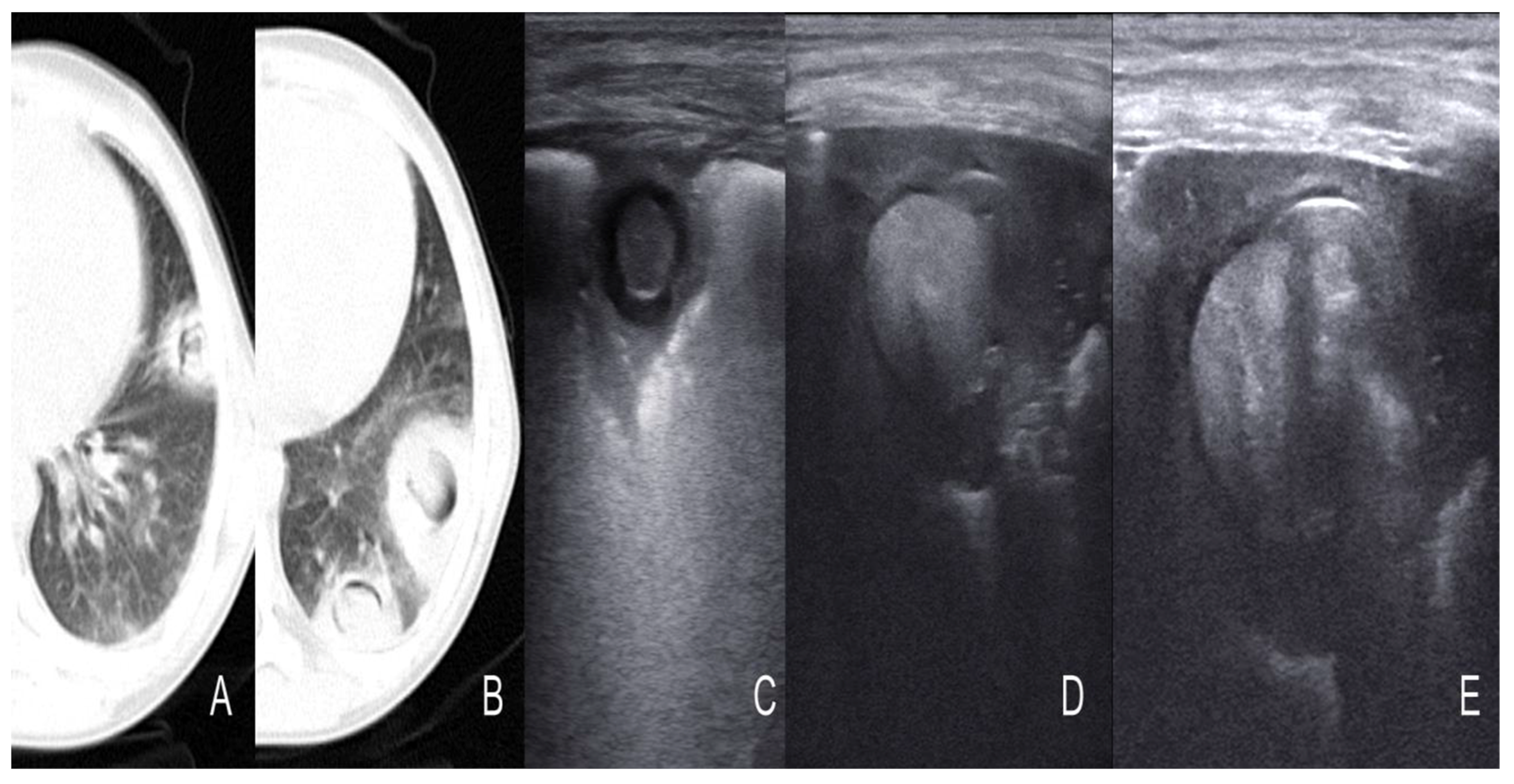 Diagnostics 13 01612 g008