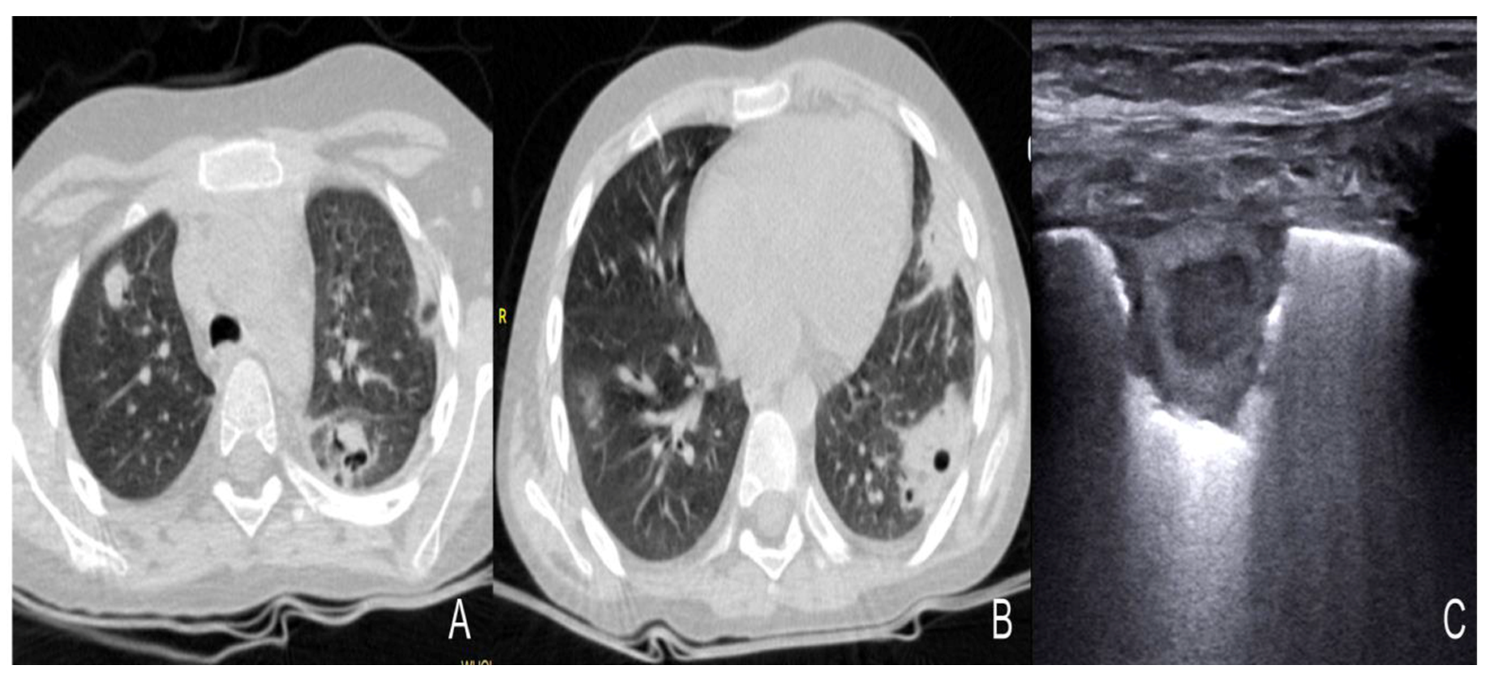 Diagnostics 13 01612 g010