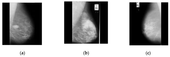 Diagnostics 13 01618 g003
