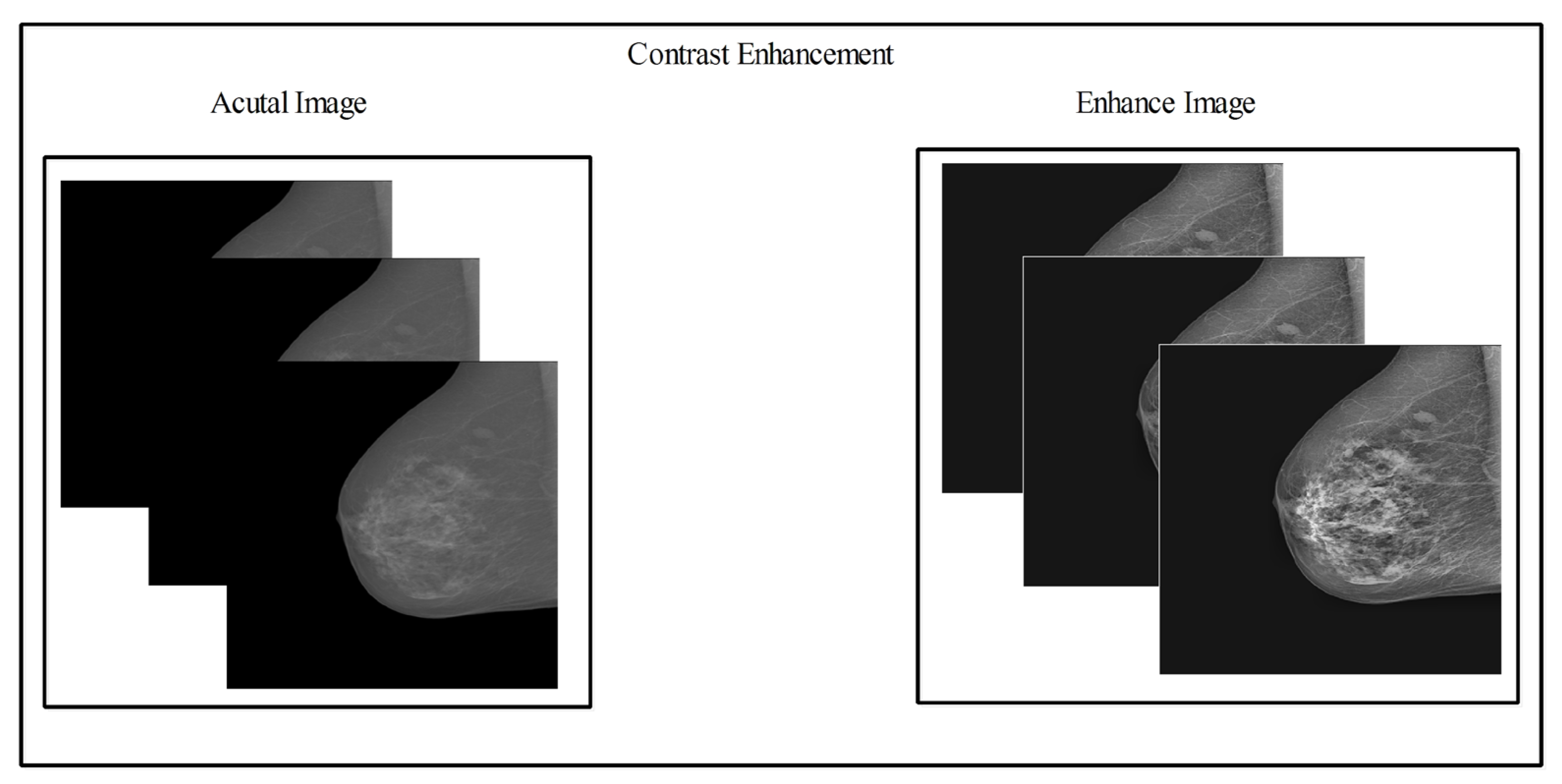 Diagnostics 13 01618 g004