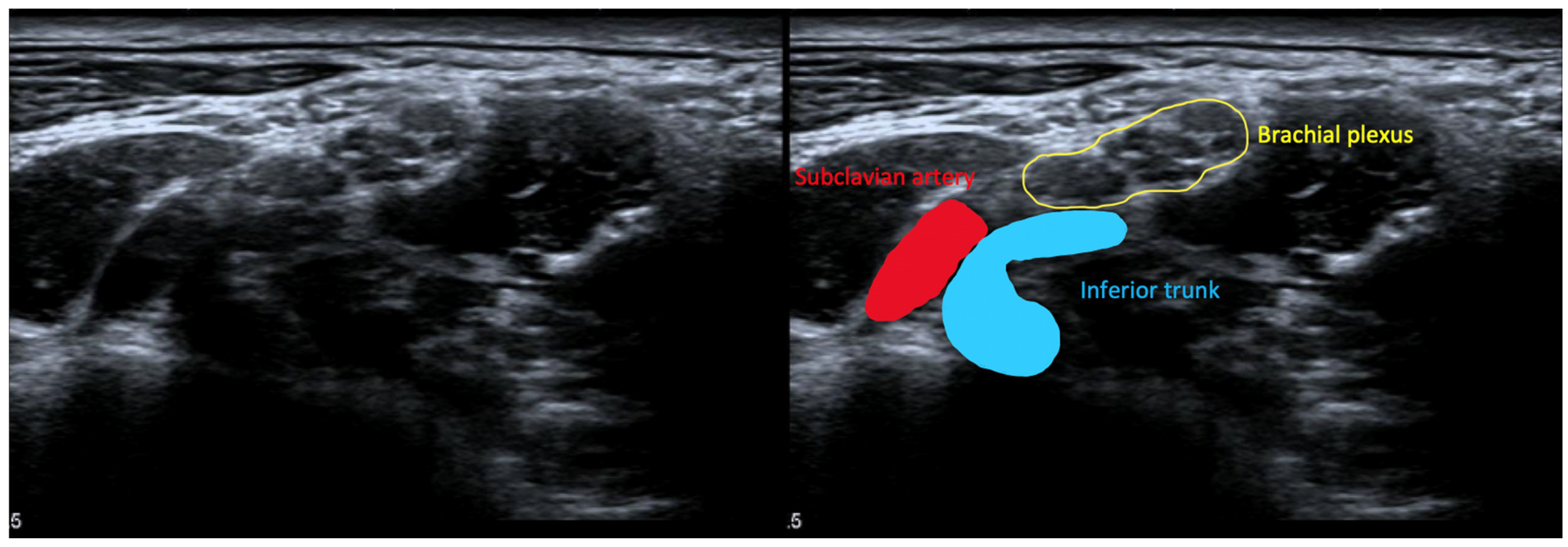 Diagnostics 13 01625 g001