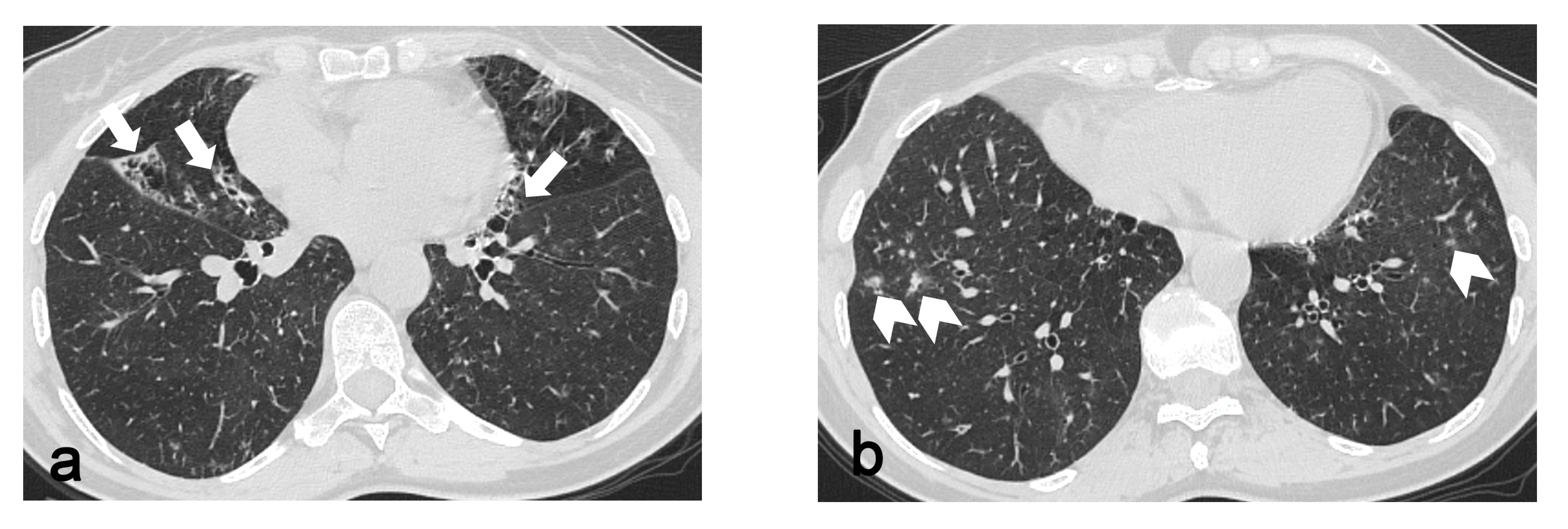 Diagnostics 13 01627 g002a