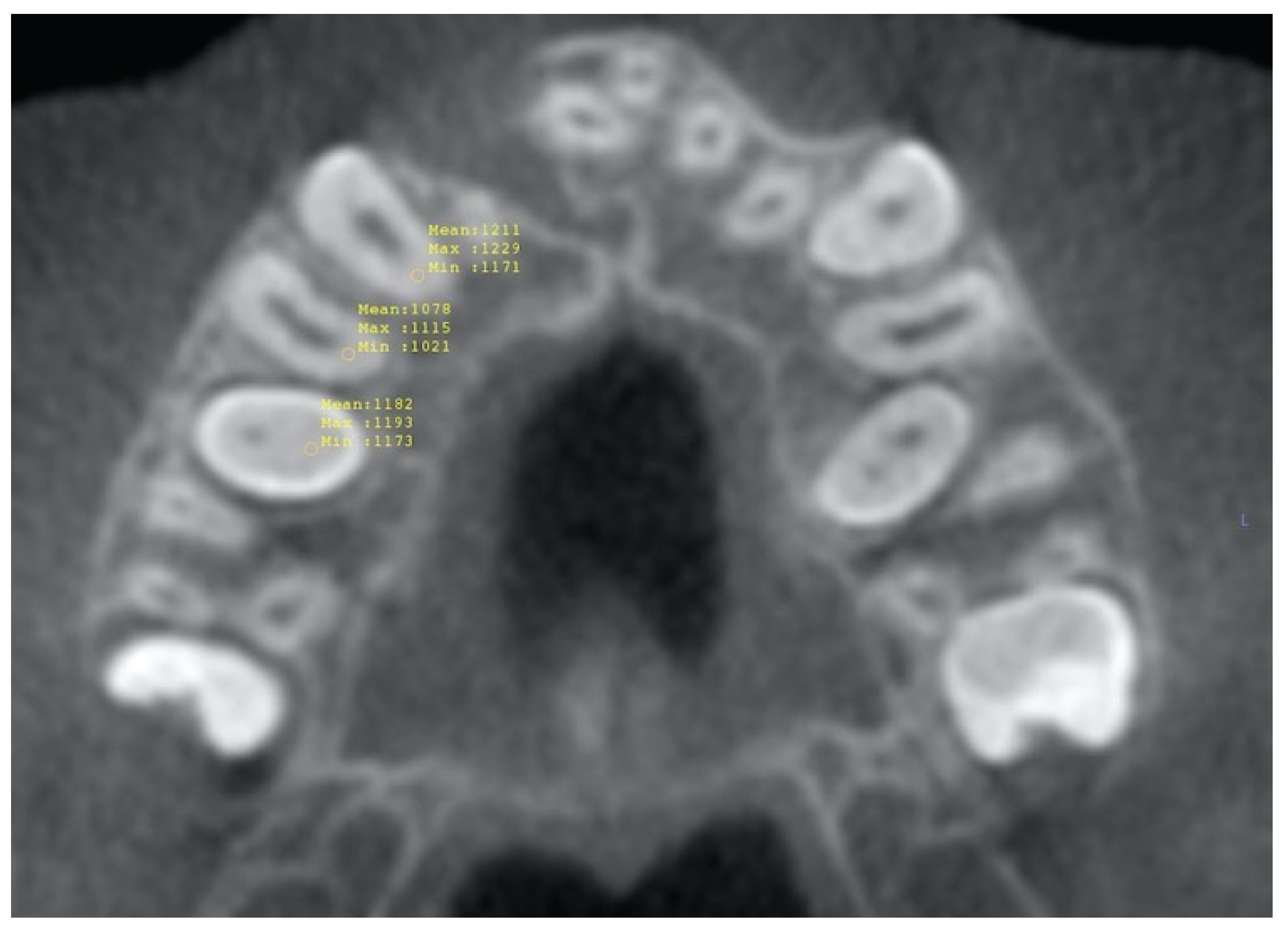 Diagnostics 13 01642 g001