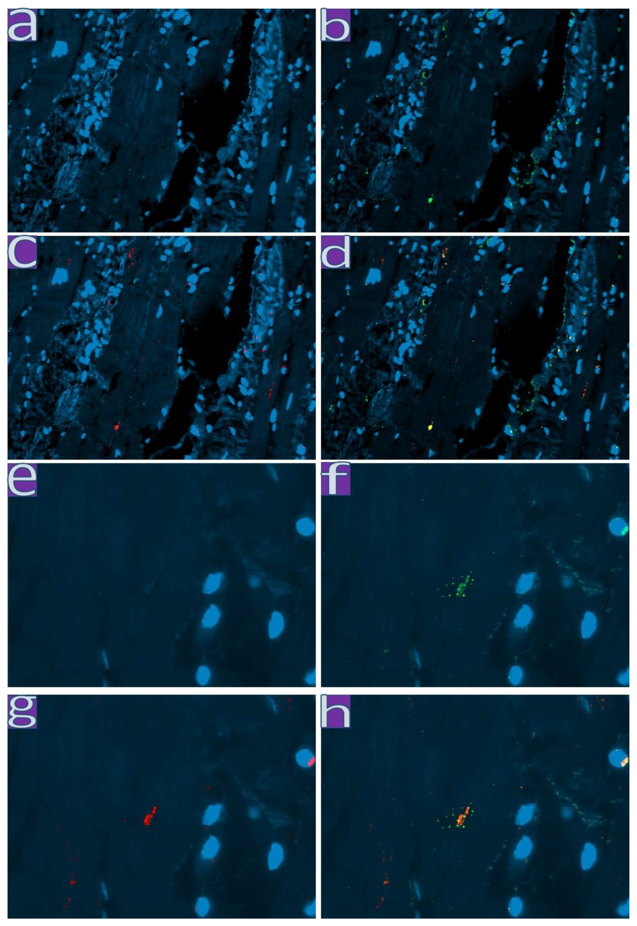 Diagnostics 13 01645 g005