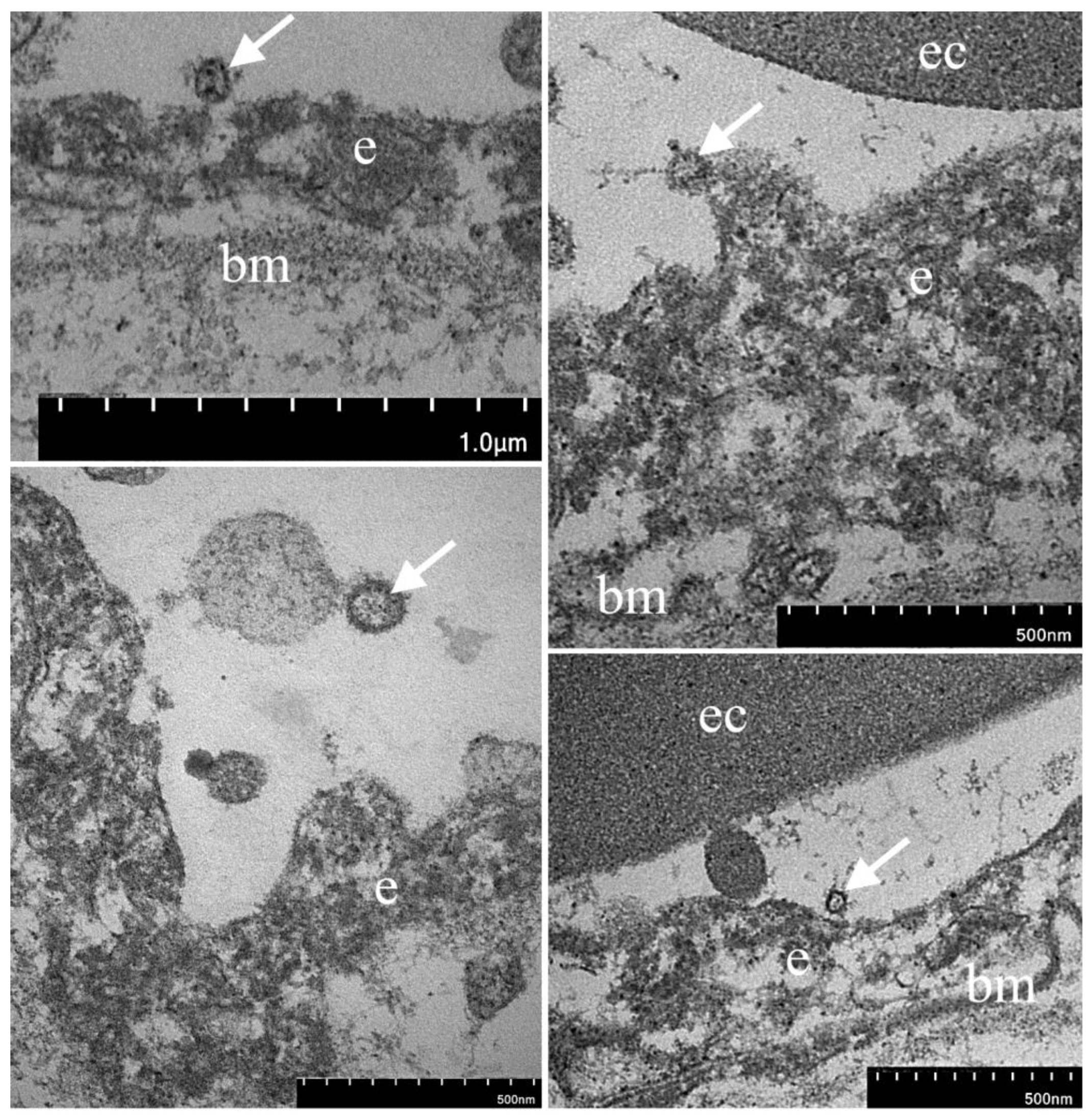 Diagnostics 13 01645 g006