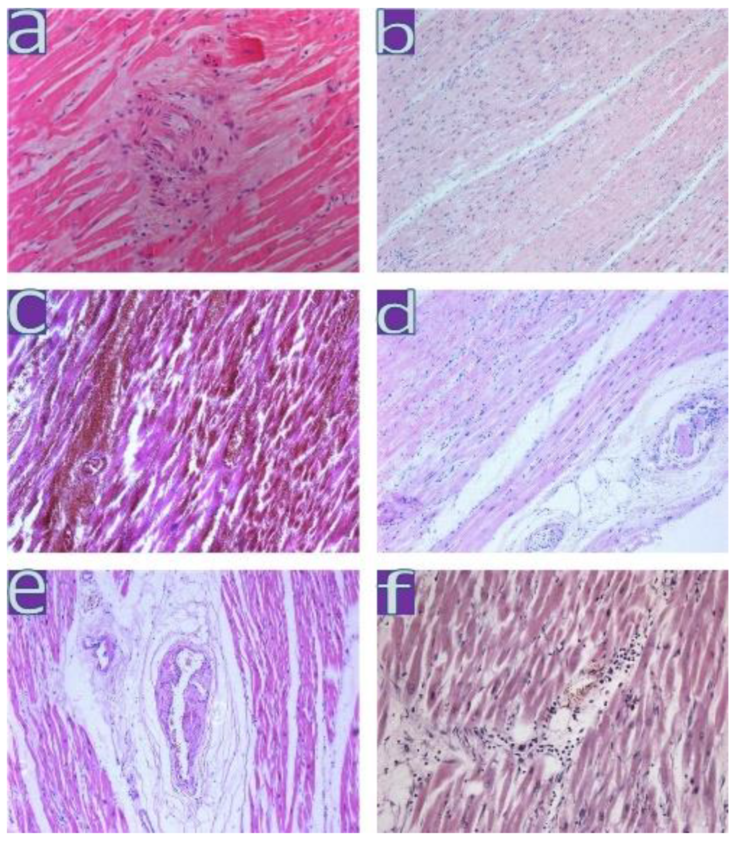 Diagnostics 13 01645 g007