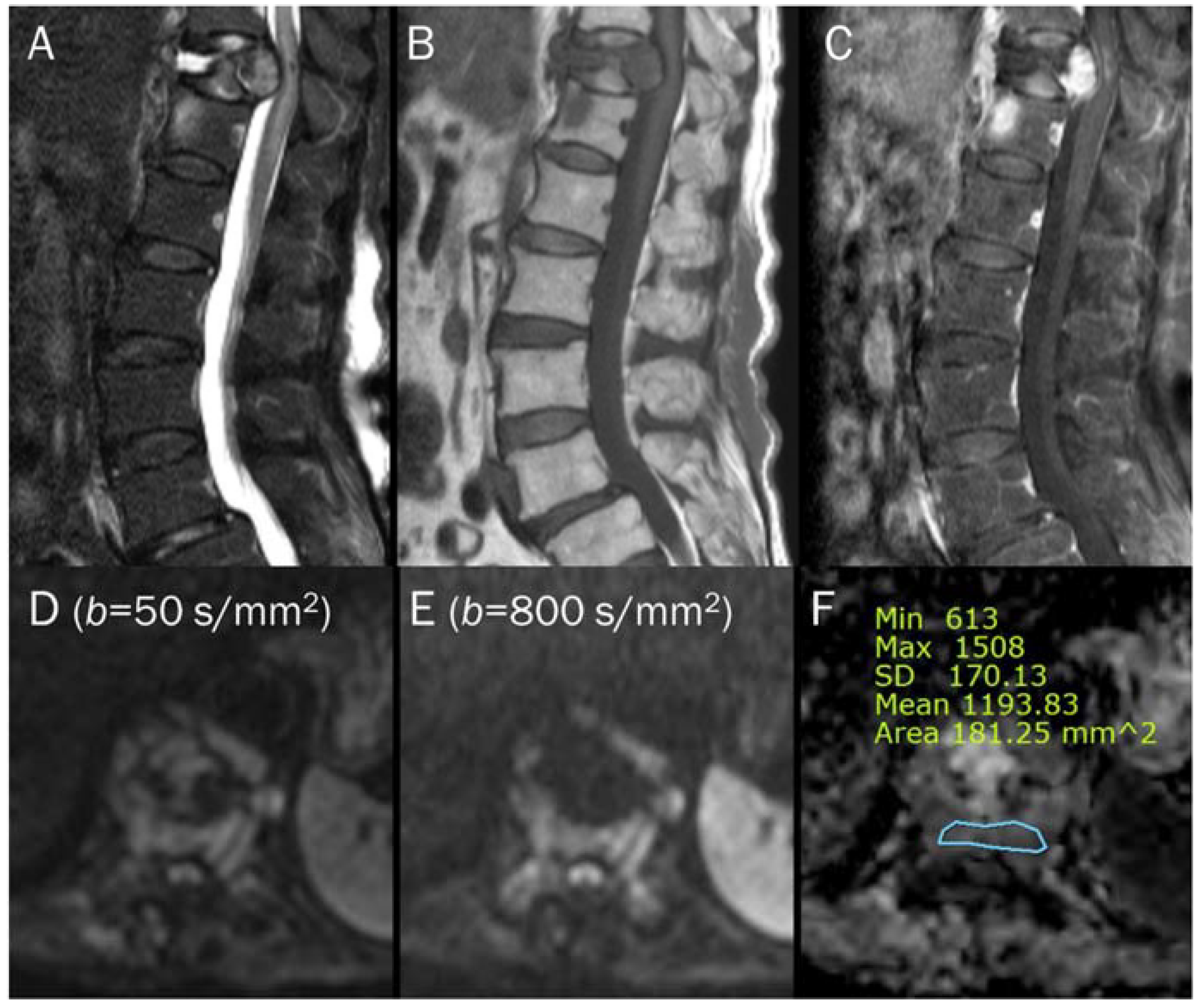 Diagnostics 13 01647 g007