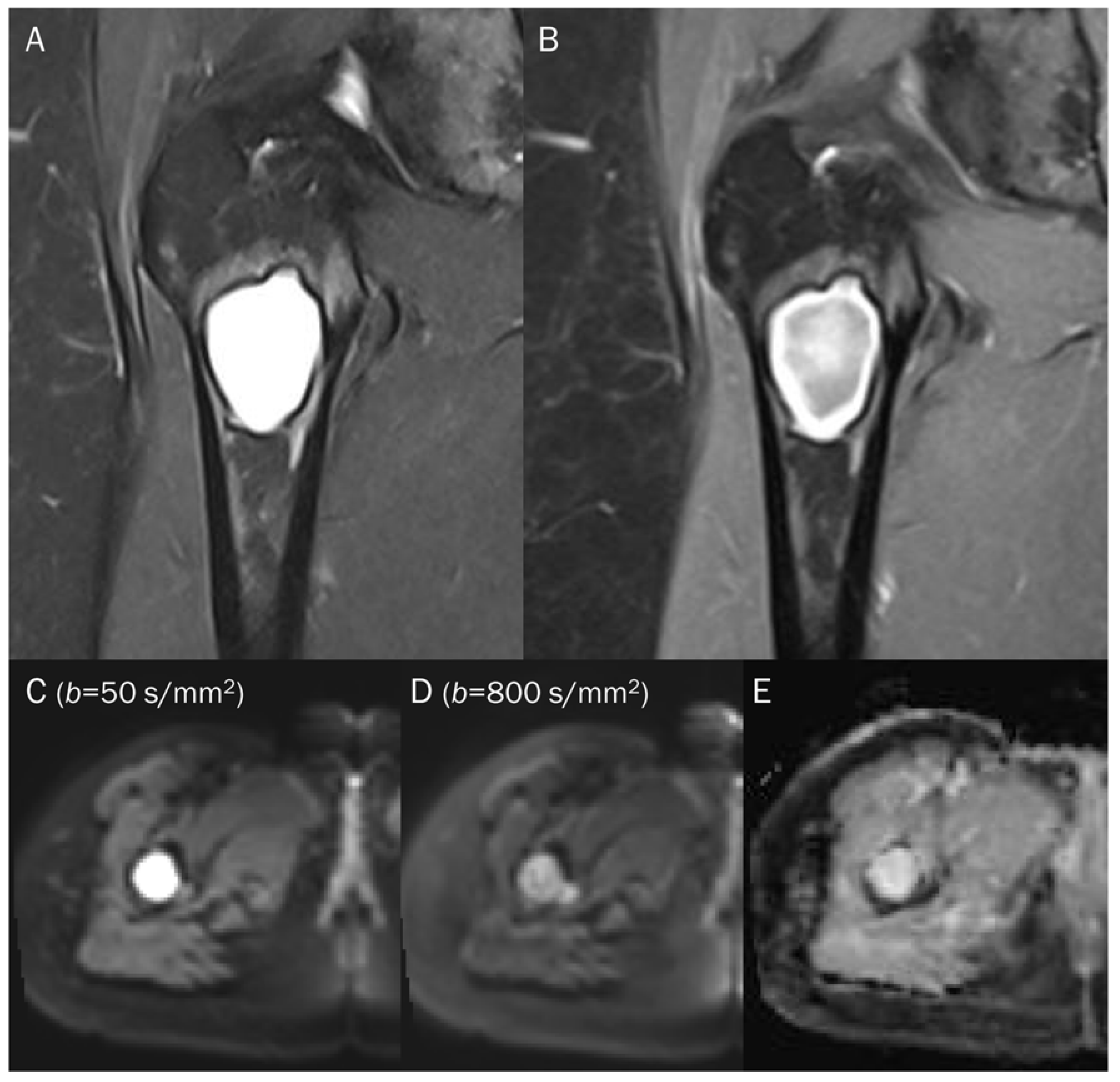 Diagnostics 13 01647 g011