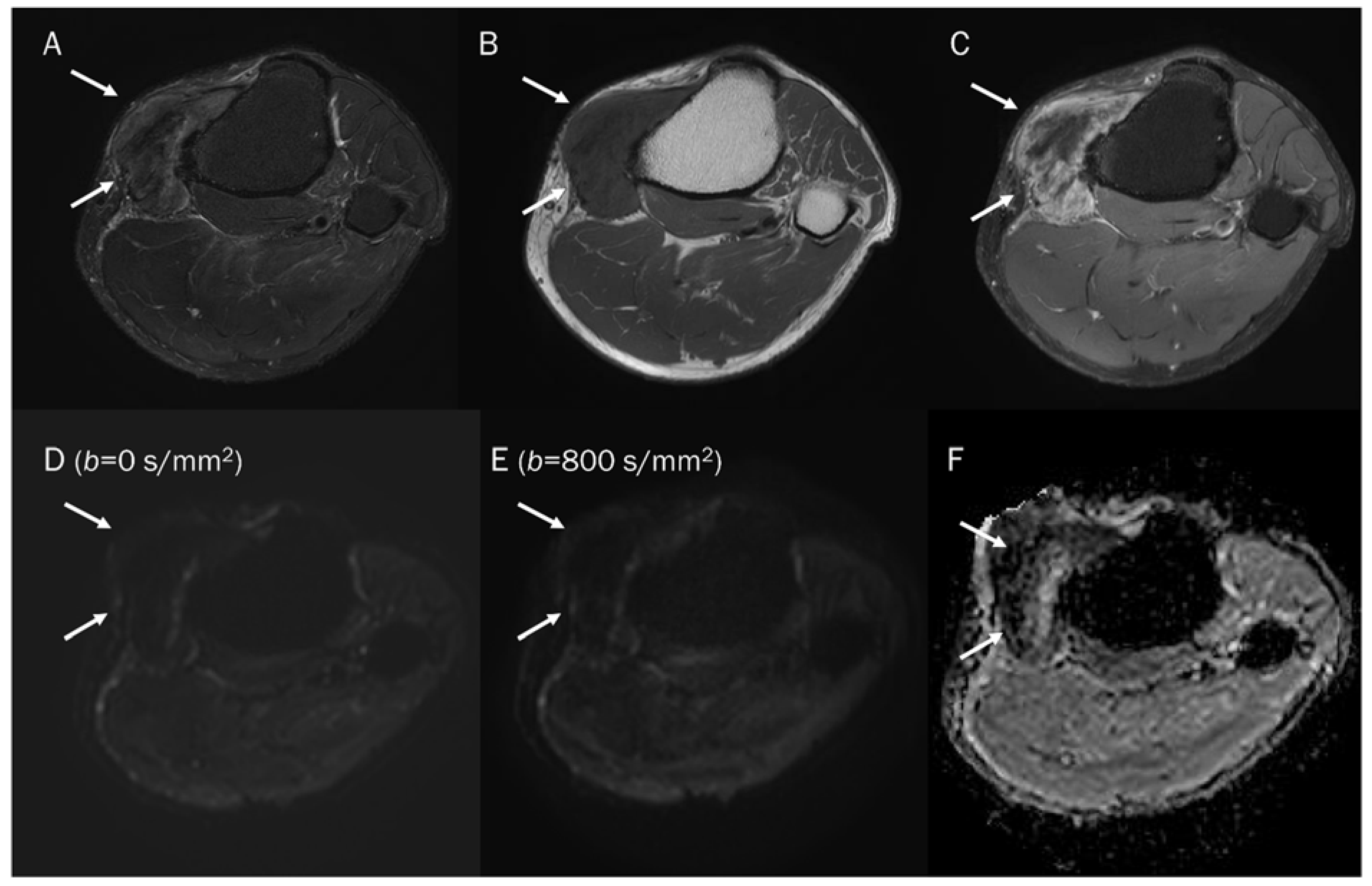 Diagnostics 13 01647 g014