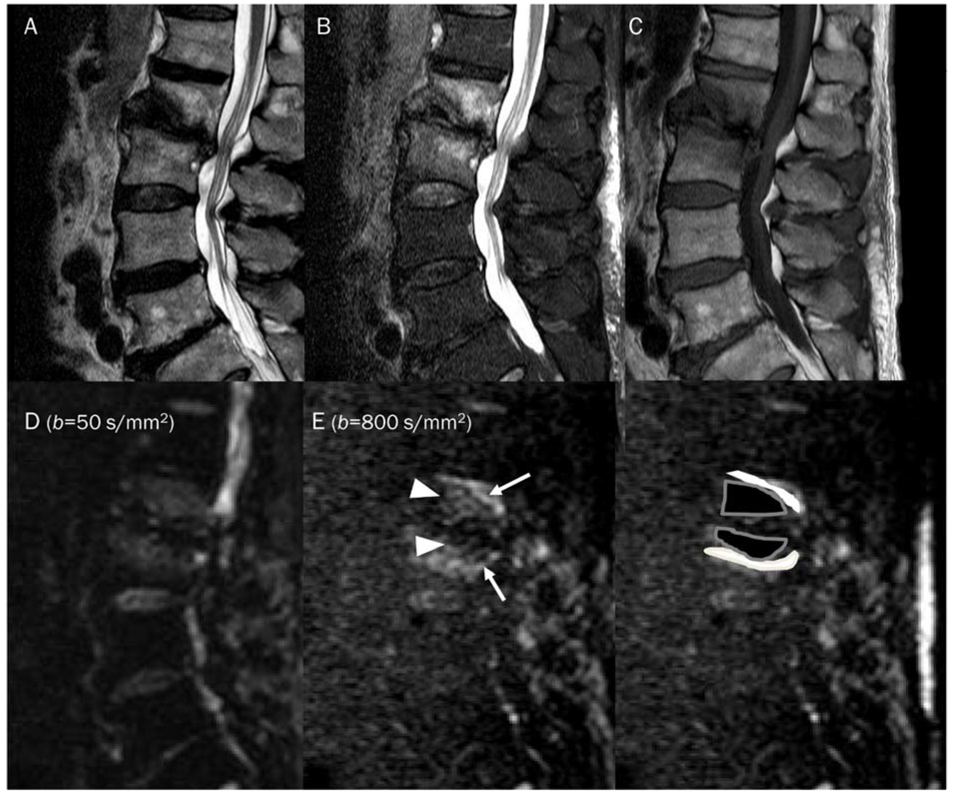 Diagnostics 13 01647 g015