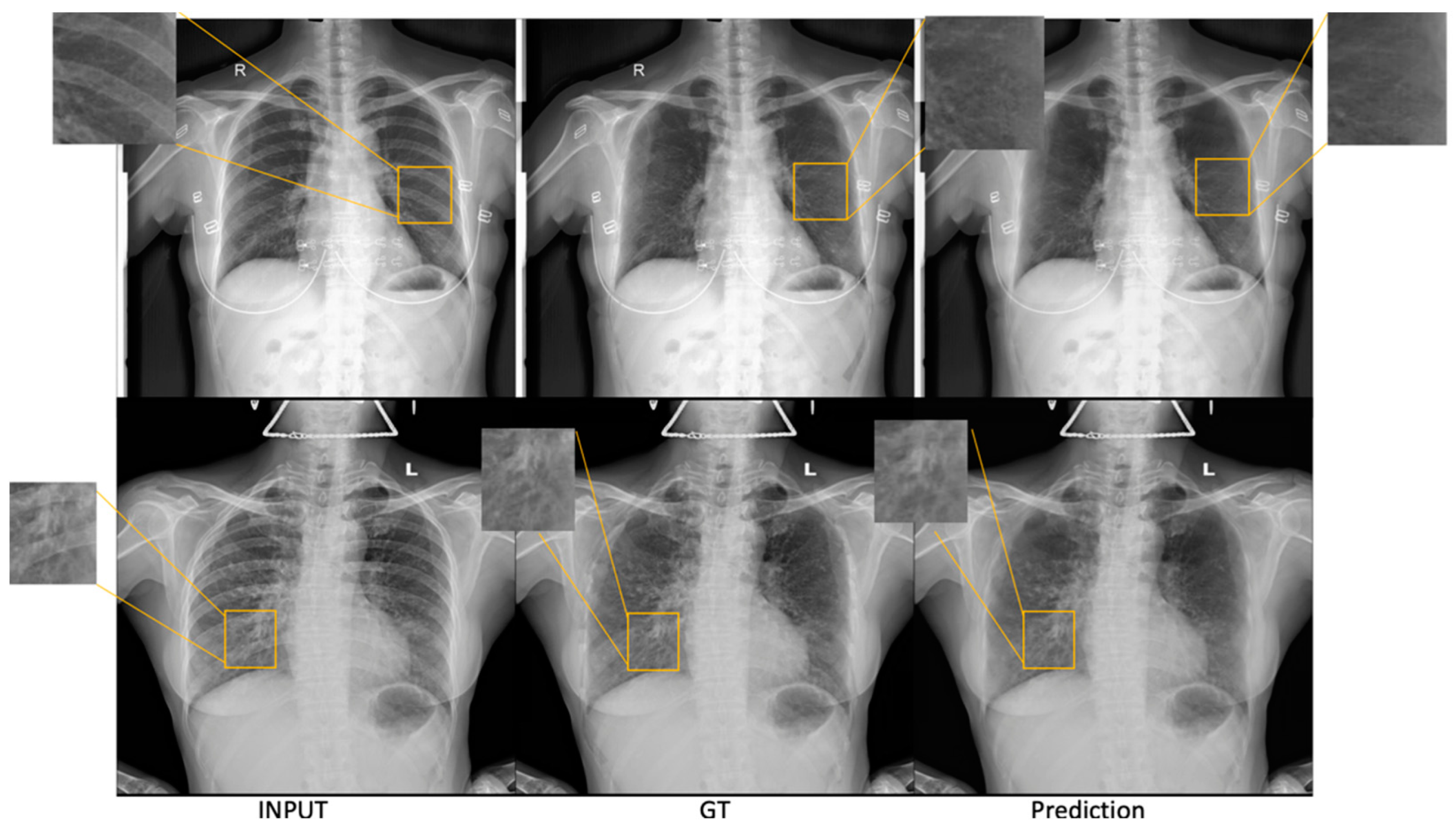 Diagnostics 13 01652 g005