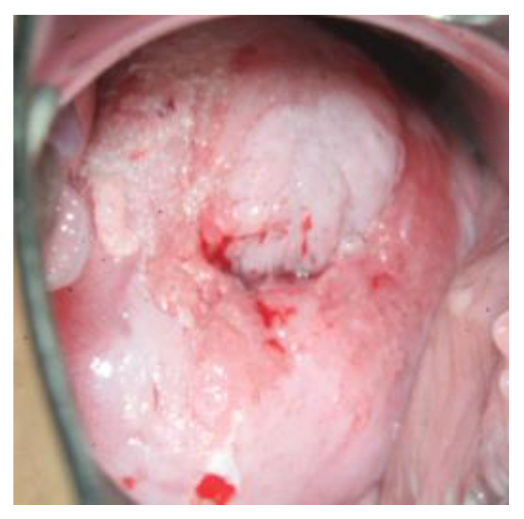 Diagnostics 13 01656 g003