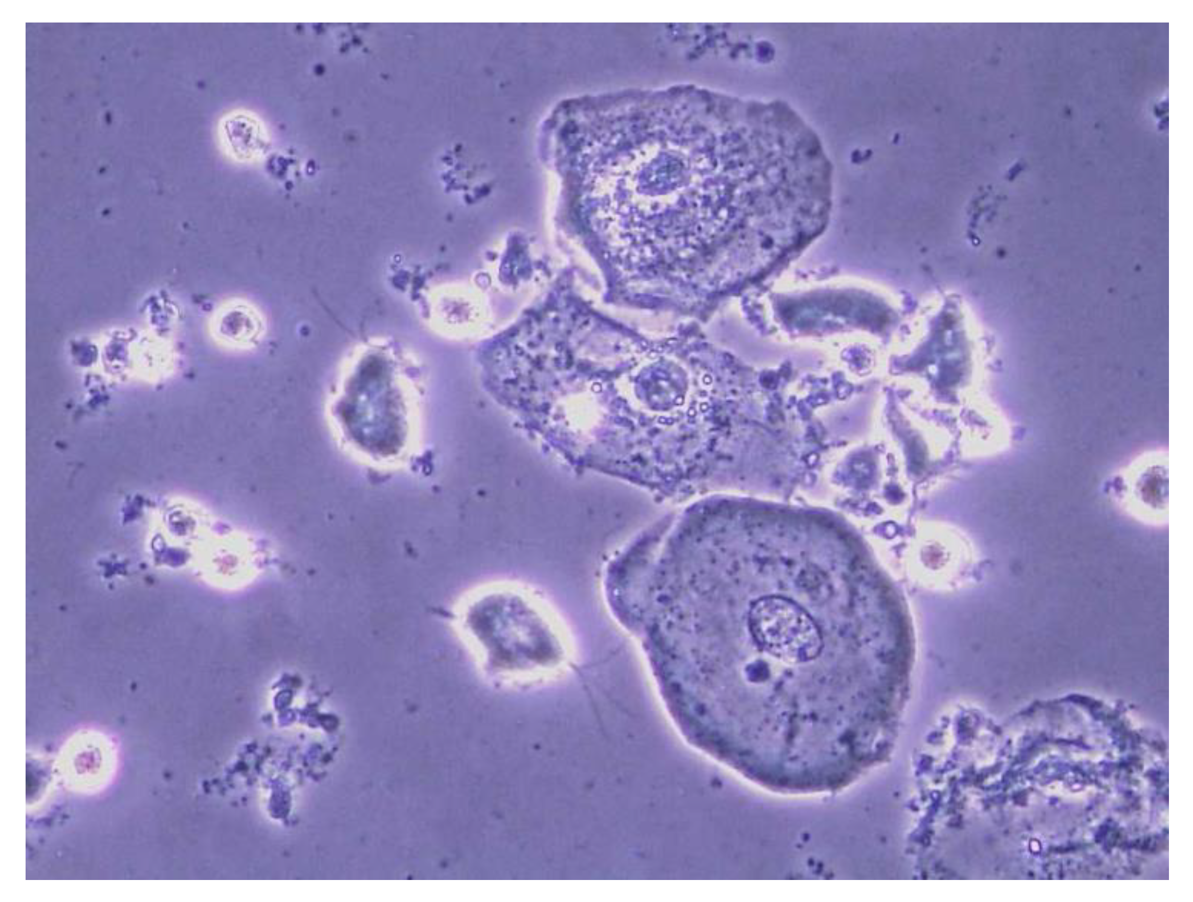 Diagnostics 13 01656 g004