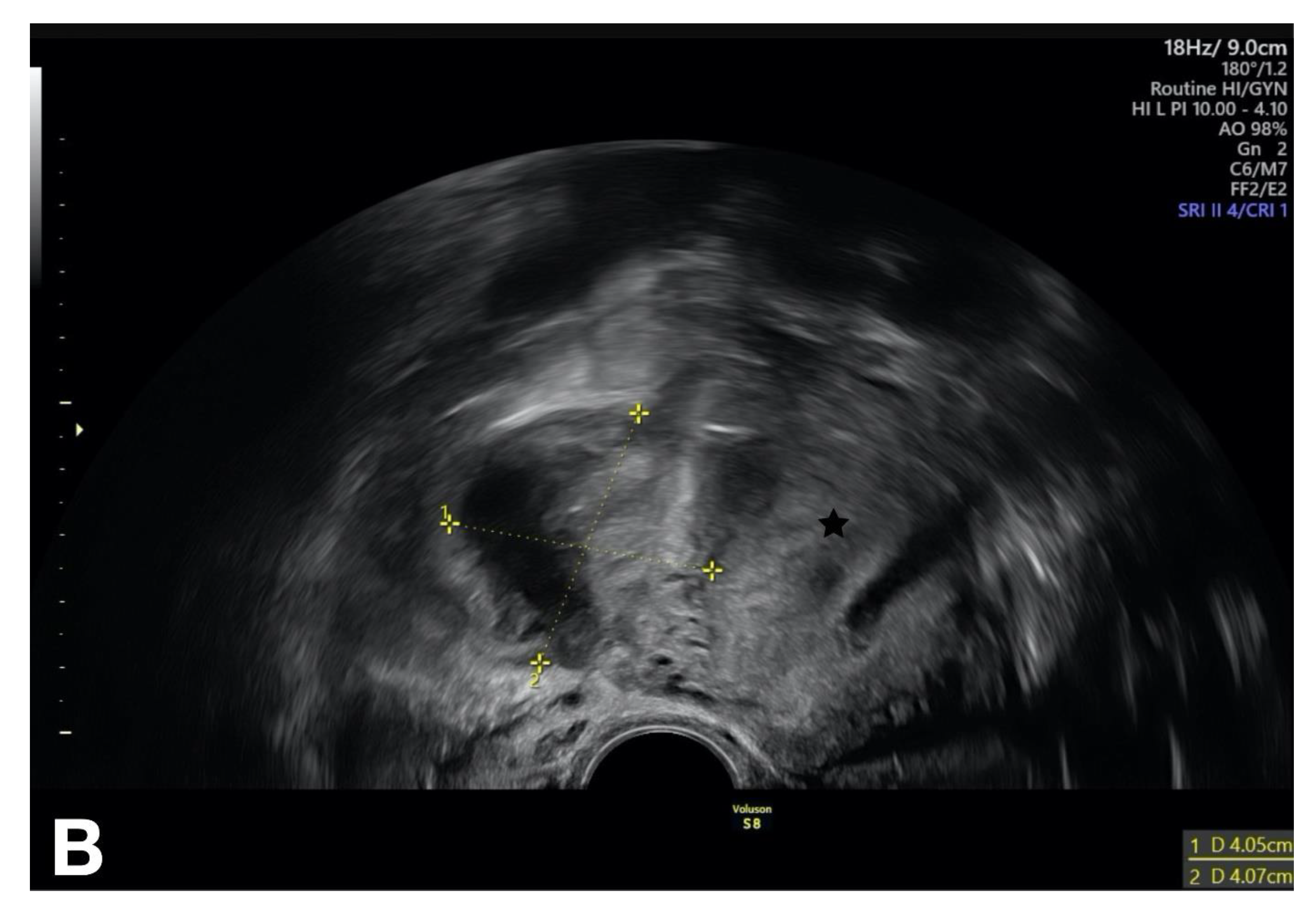 Diagnostics 13 01656 g008