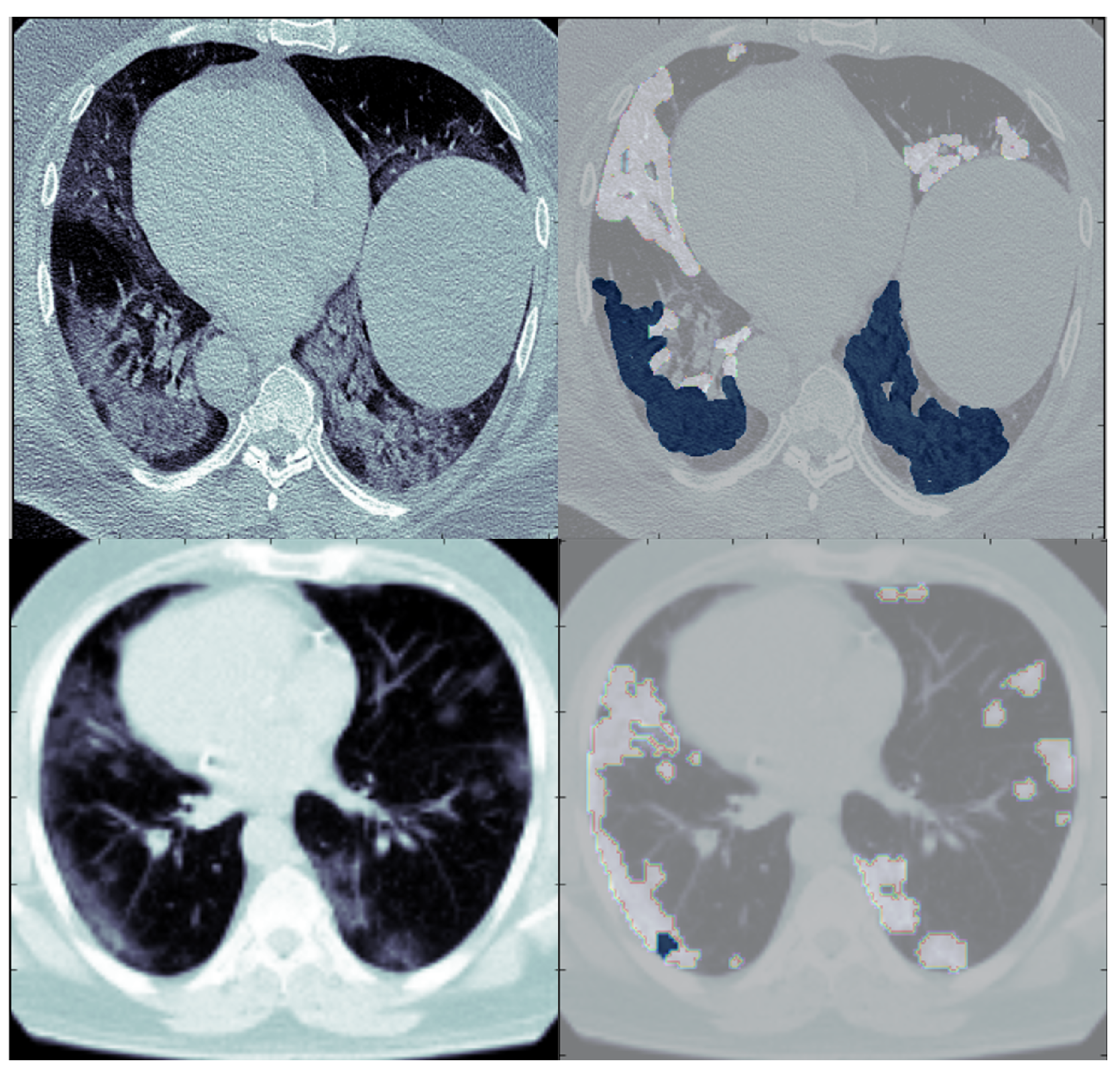 Diagnostics 13 01658 g001 Diagnostics 13 01658 g001