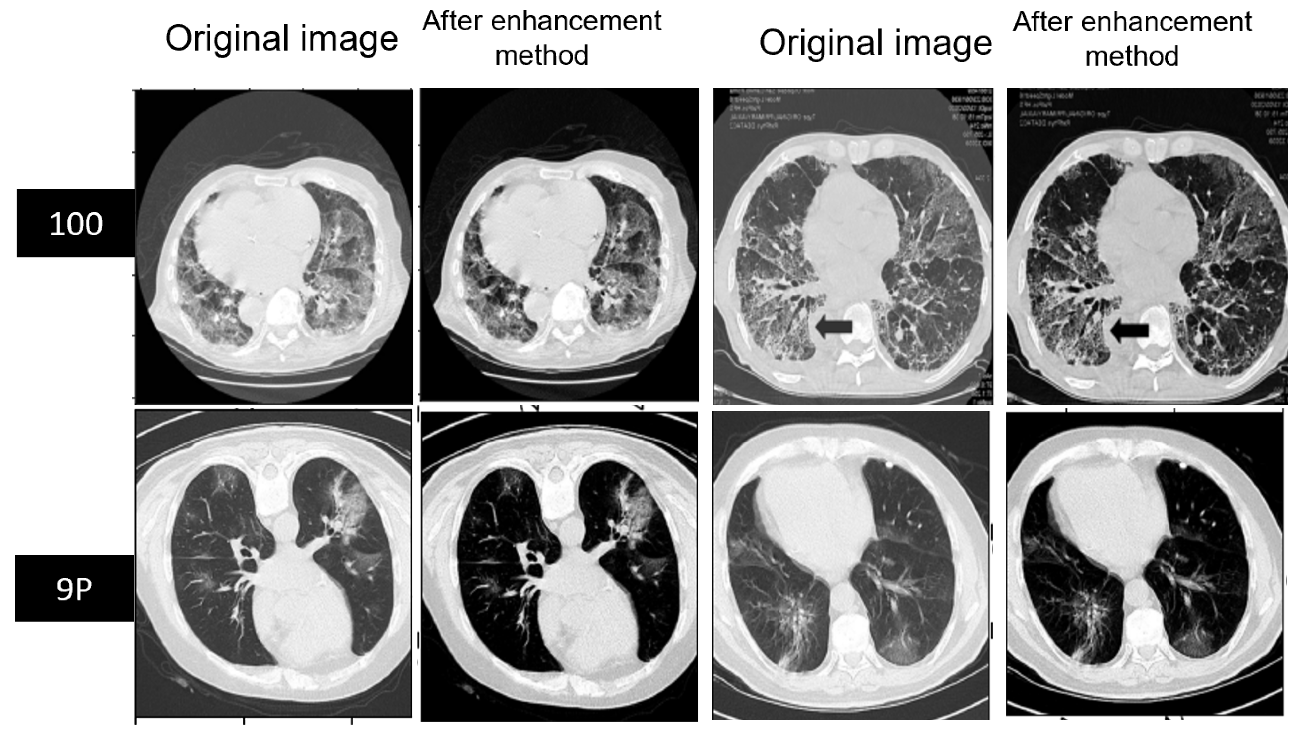 Diagnostics 13 01658 g007 Diagnostics 13 01658 g007