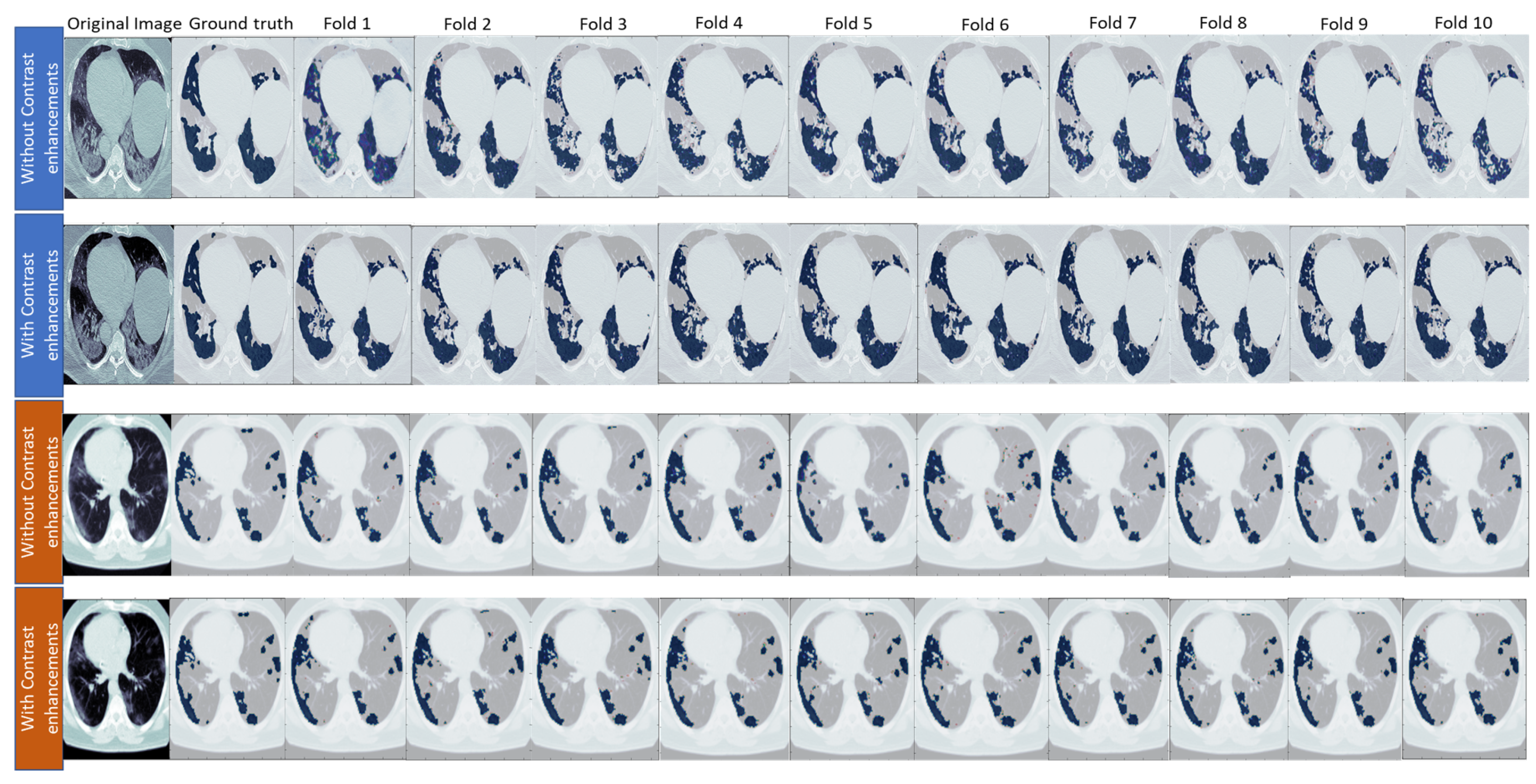 Diagnostics 13 01658 g012 Diagnostics 13 01658 g012