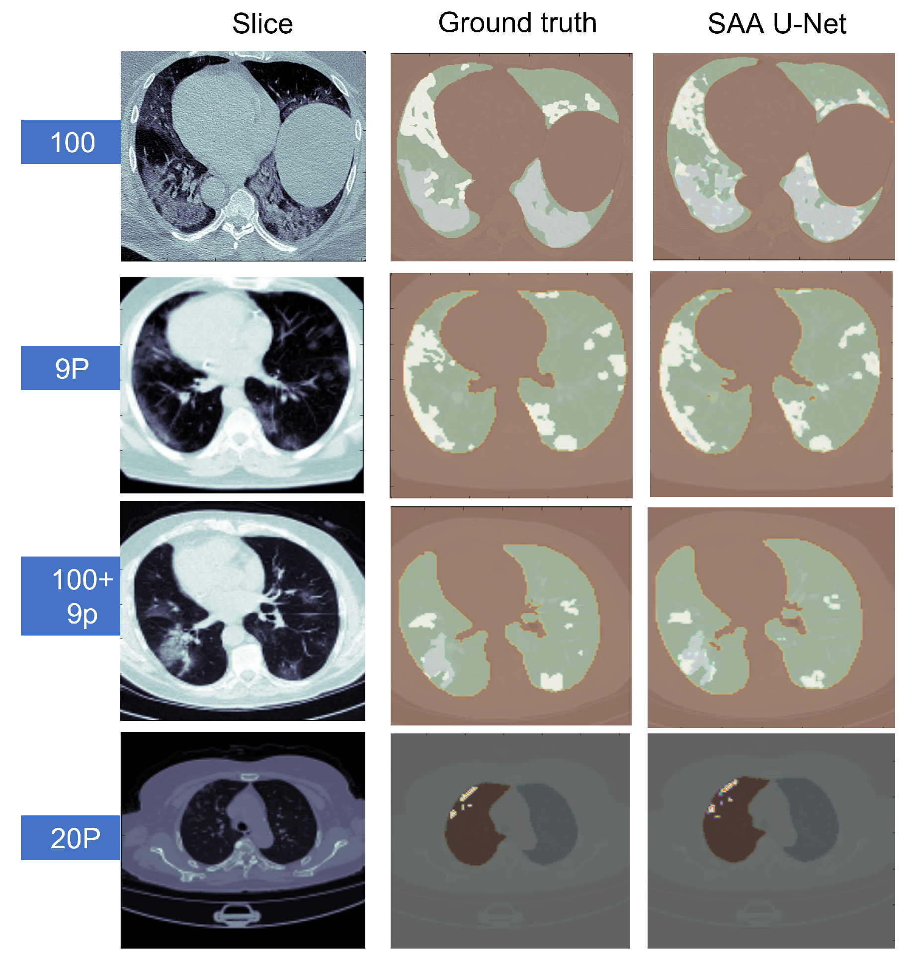 Diagnostics 13 01658 g013 Diagnostics 13 01658 g013