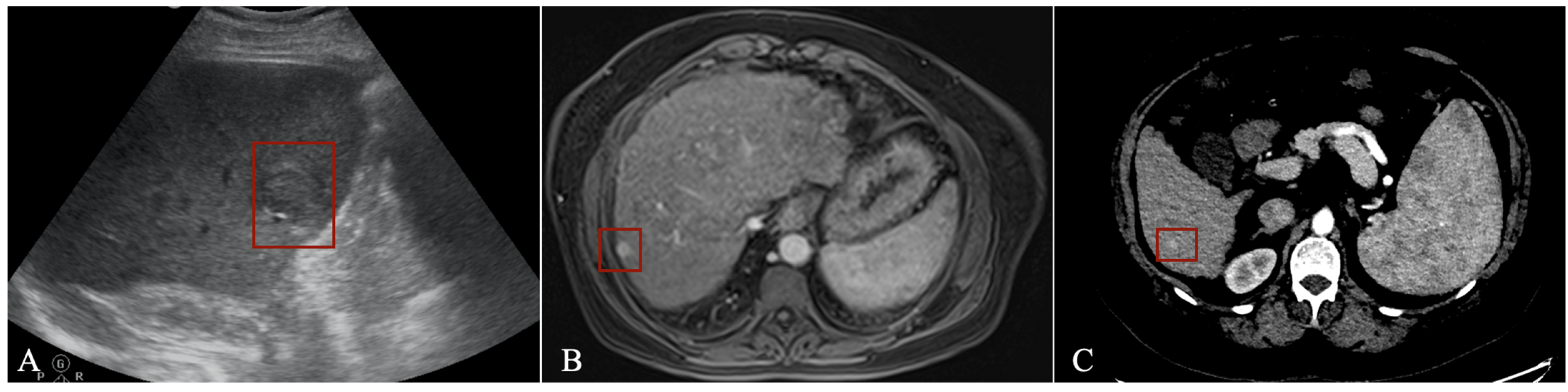 Diagnostics 13 01663 g005