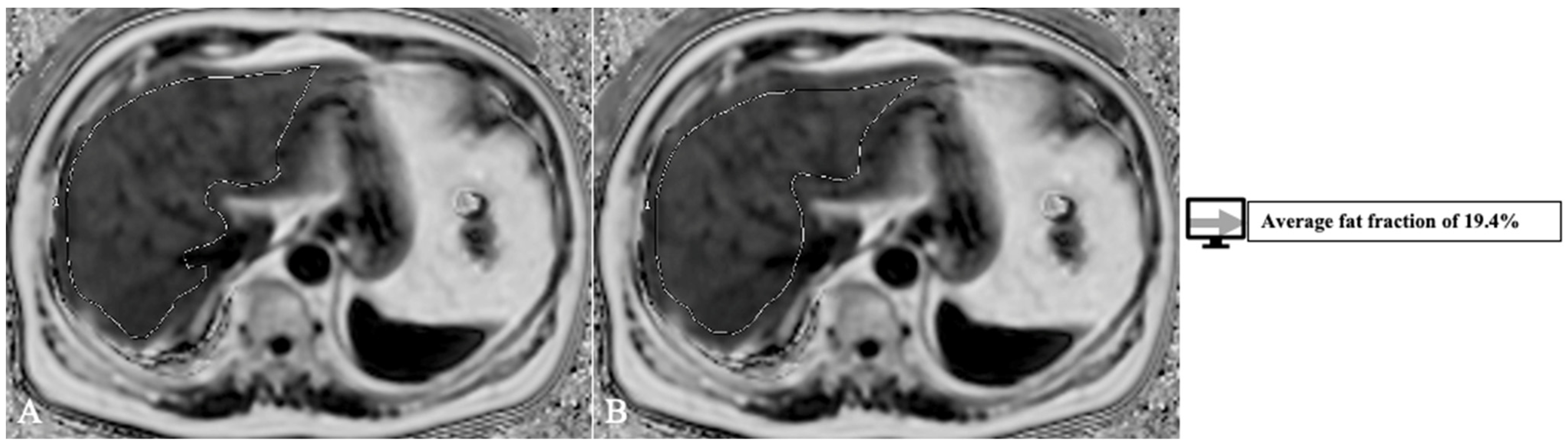 Diagnostics 13 01663 g007