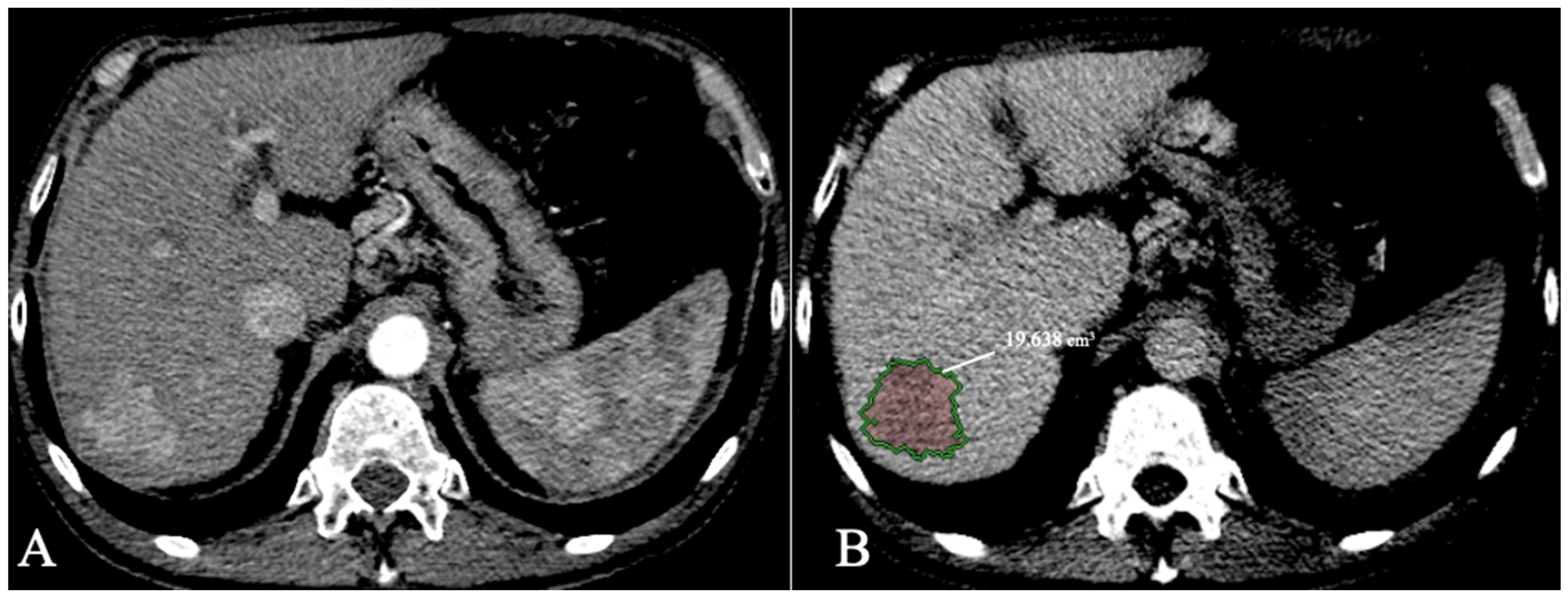 Diagnostics 13 01663 g008