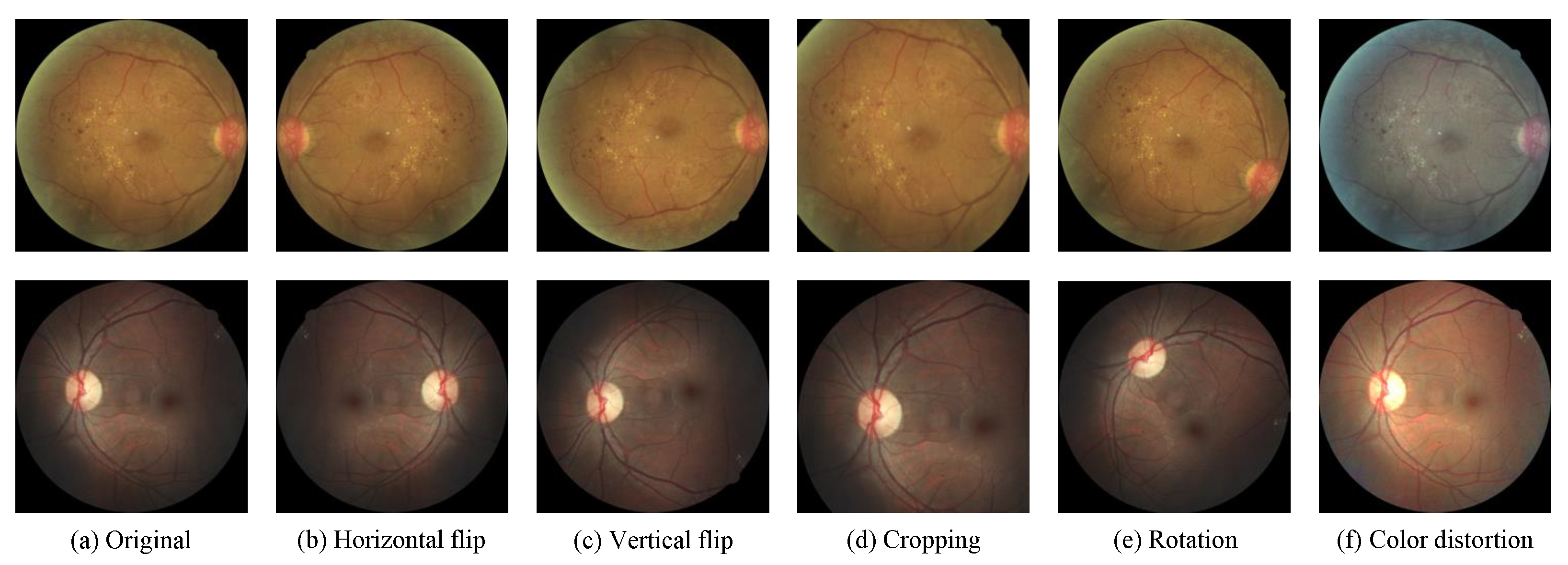 Diagnostics 13 01664 g004