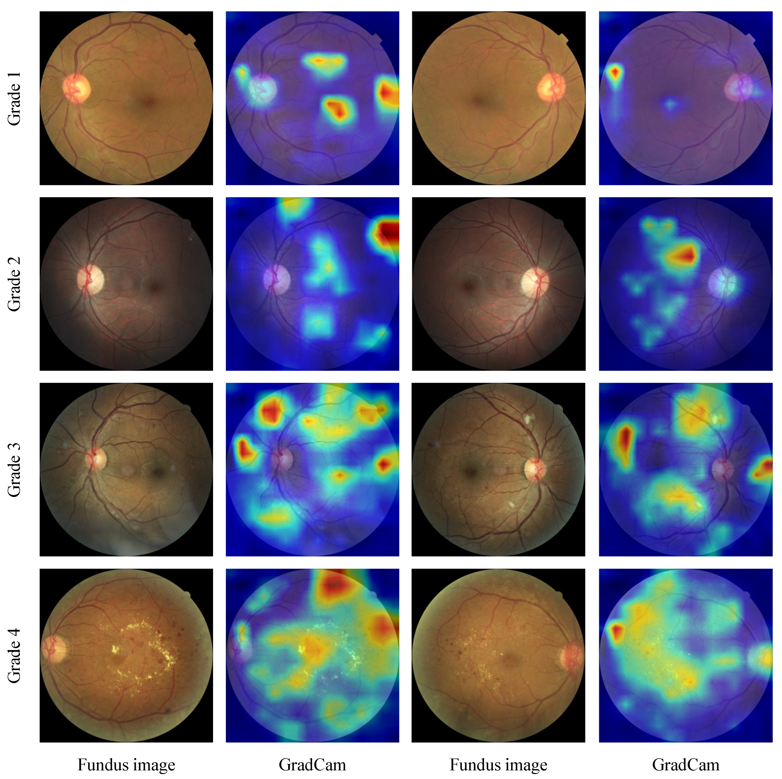 Diagnostics 13 01664 g010