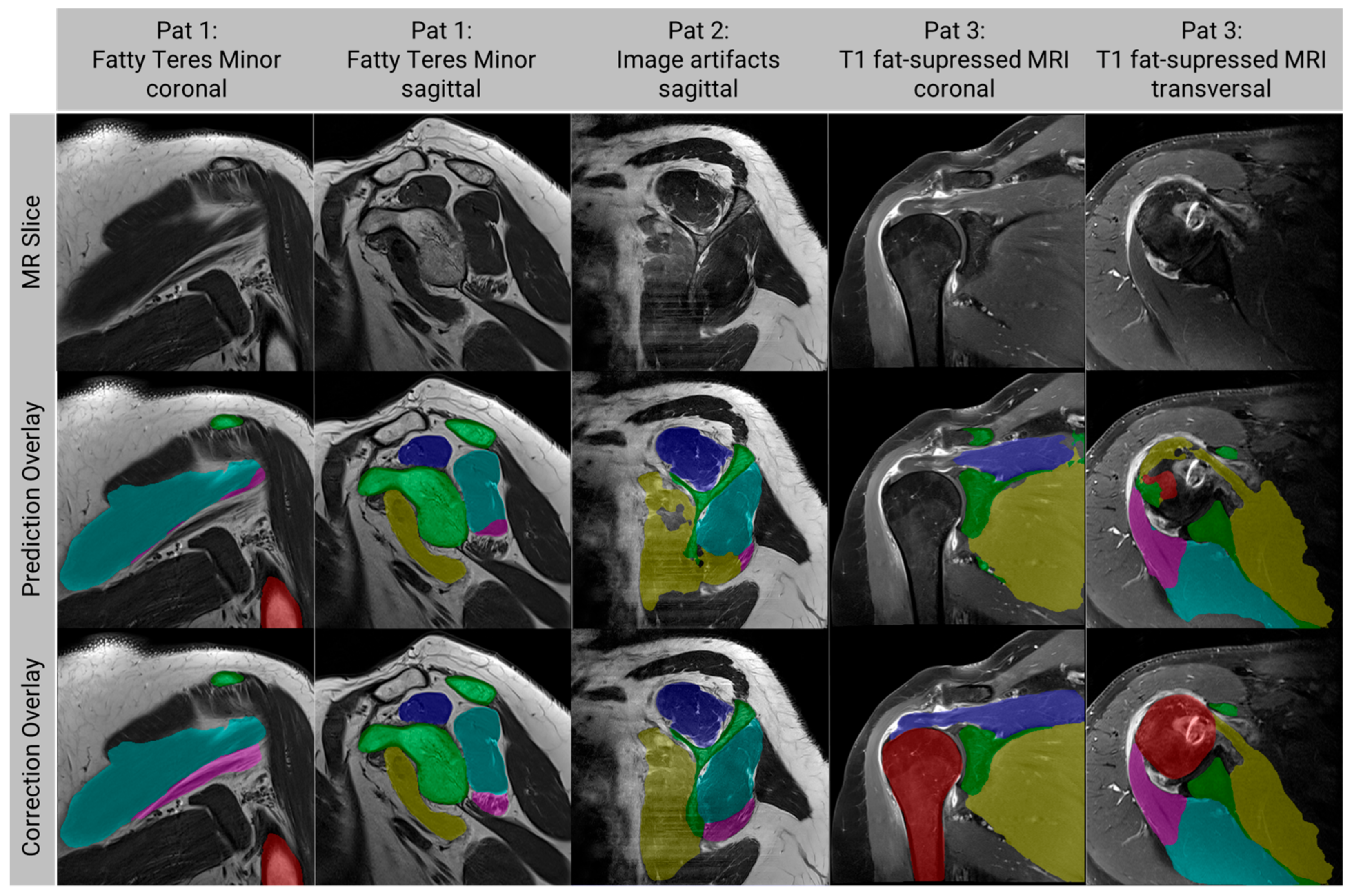 Diagnostics 13 01668 g005