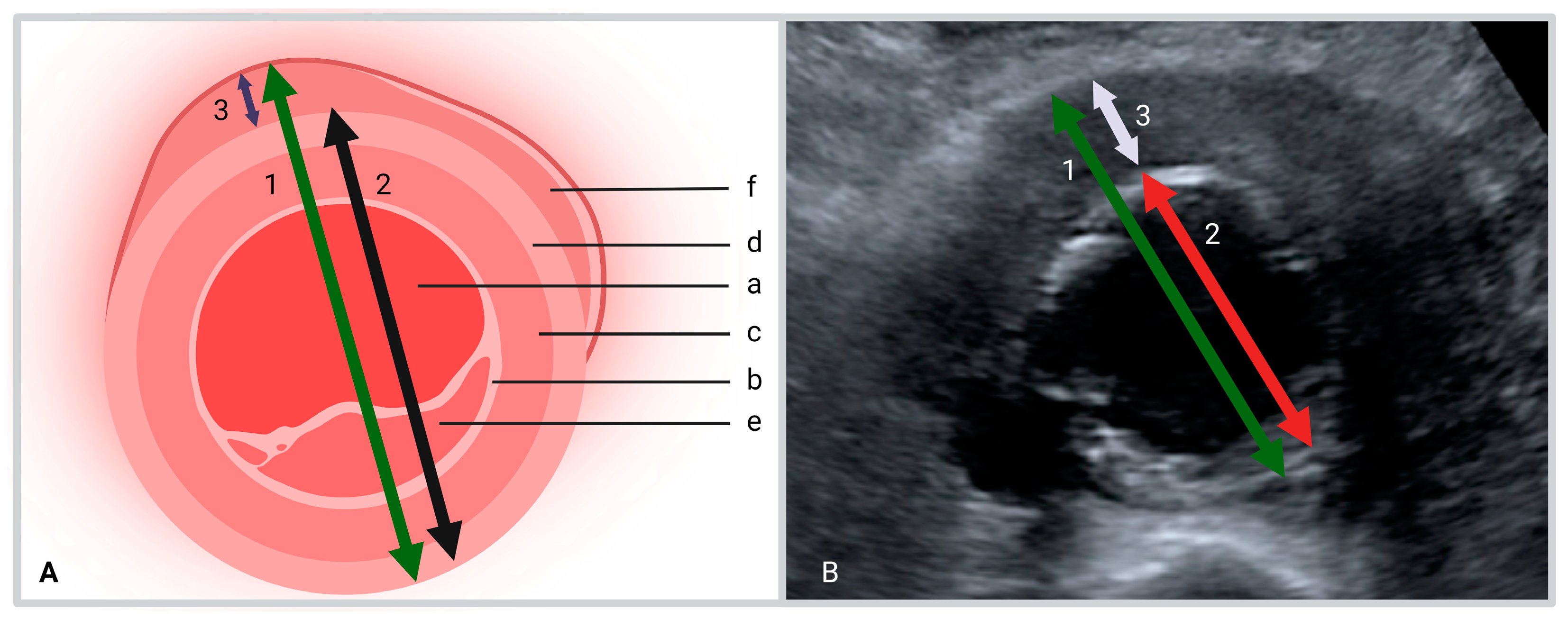 Diagnostics 13 01669 g001