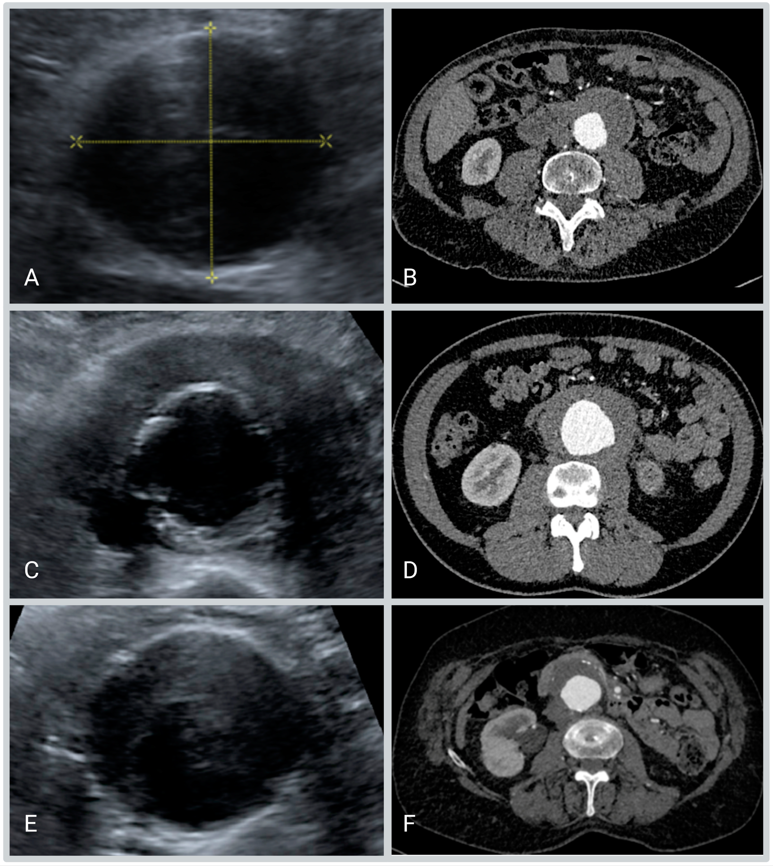 Diagnostics 13 01669 g003