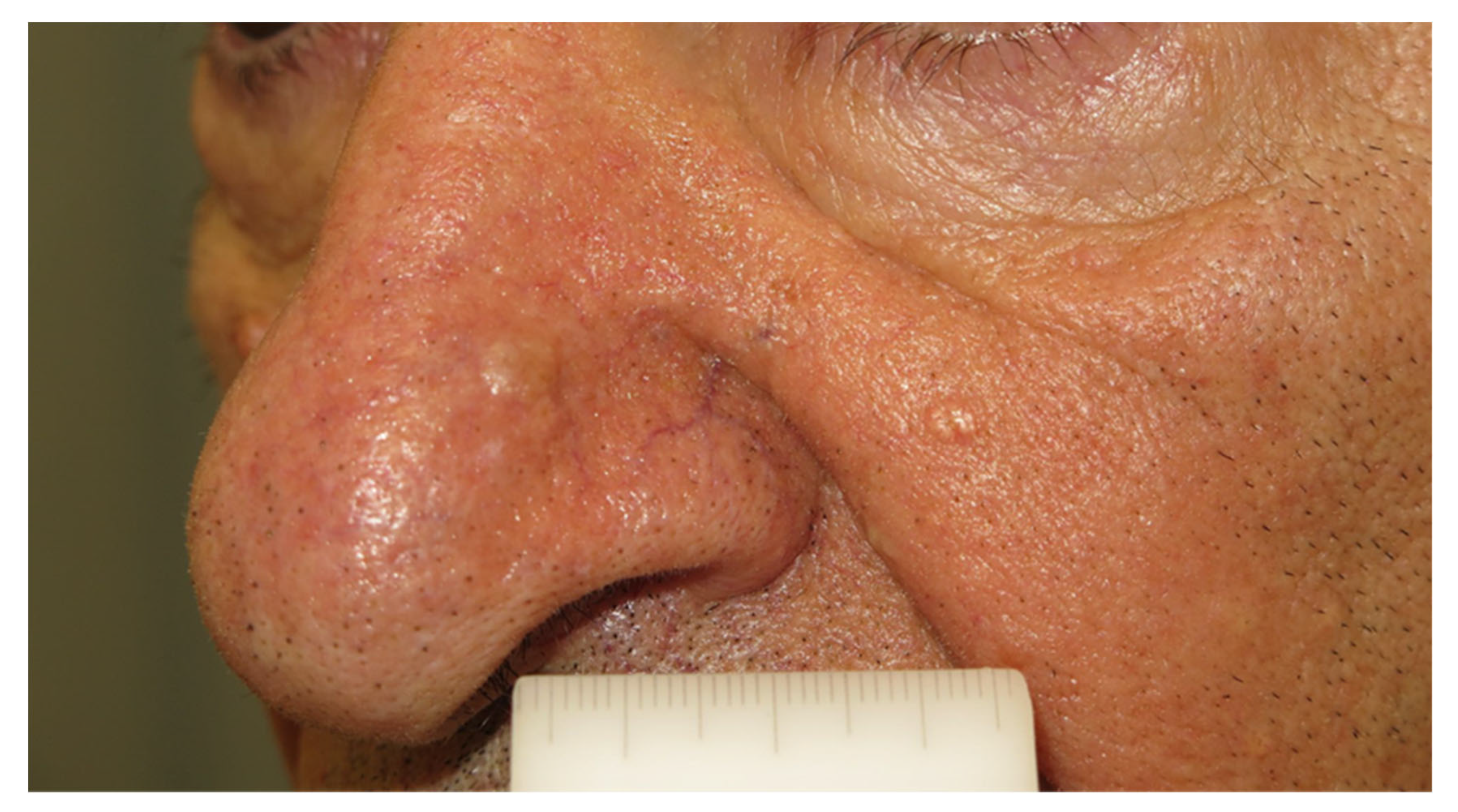 Diagnostics 13 01676 g001