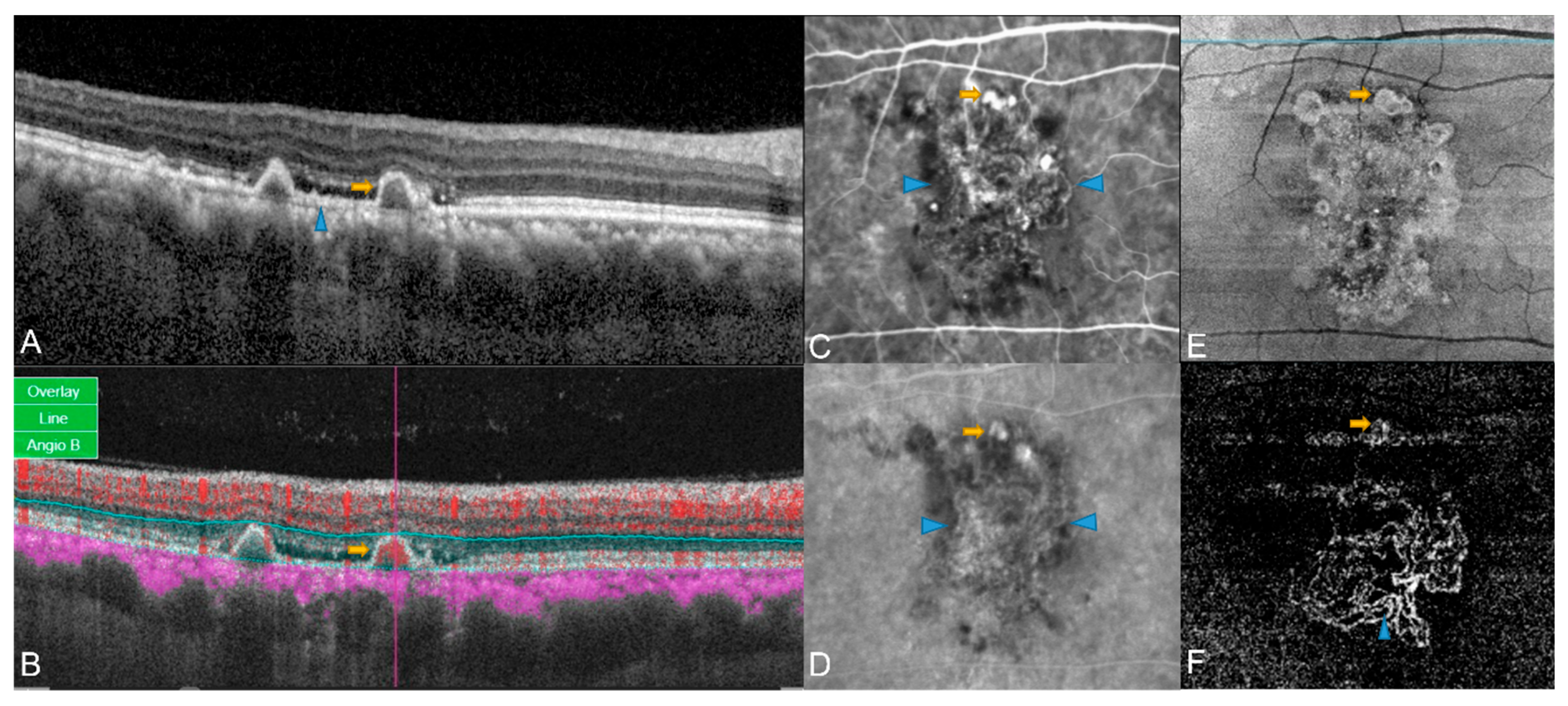Diagnostics 13 01680 g002