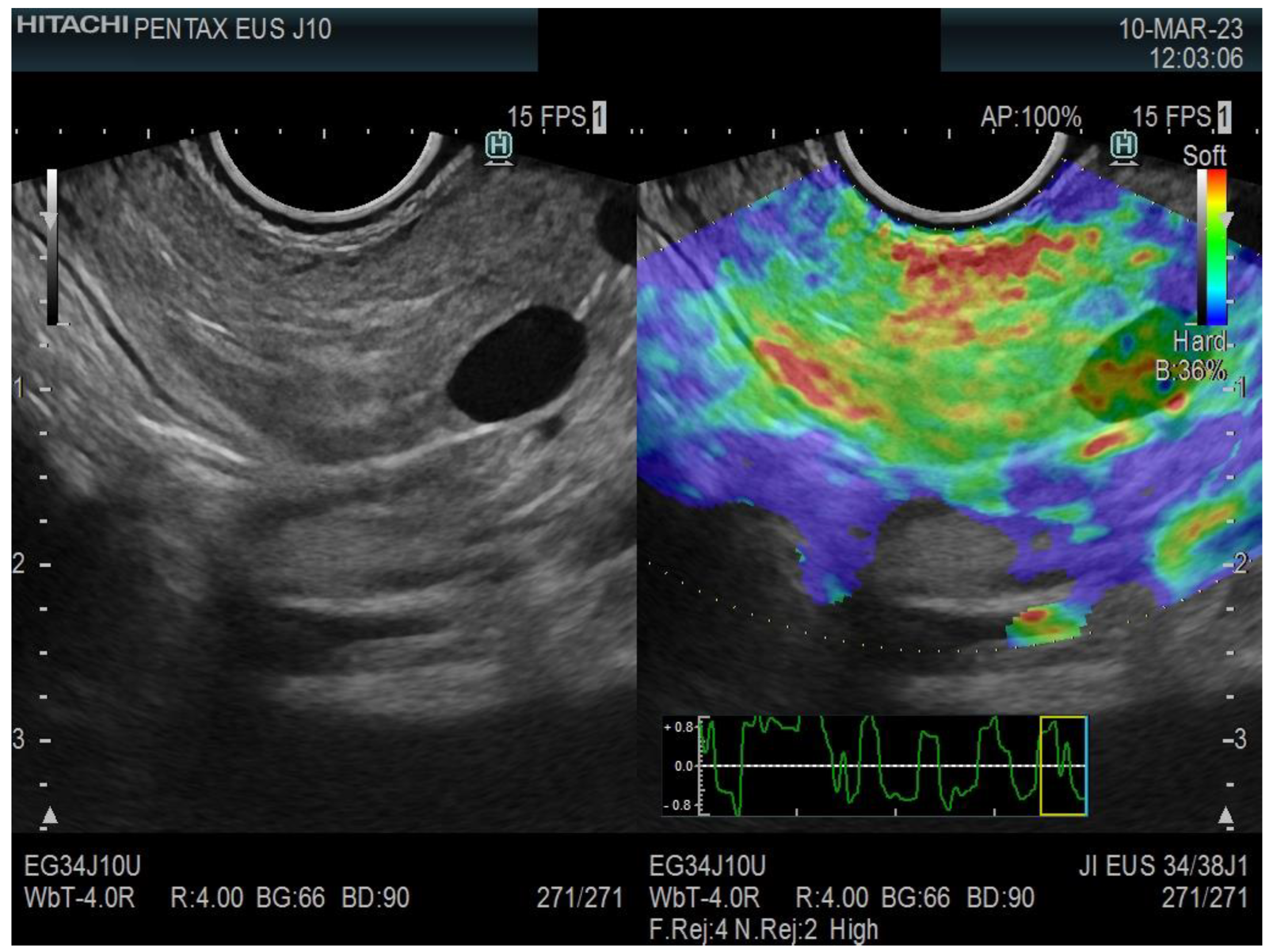 Diagnostics 13 01686 g001