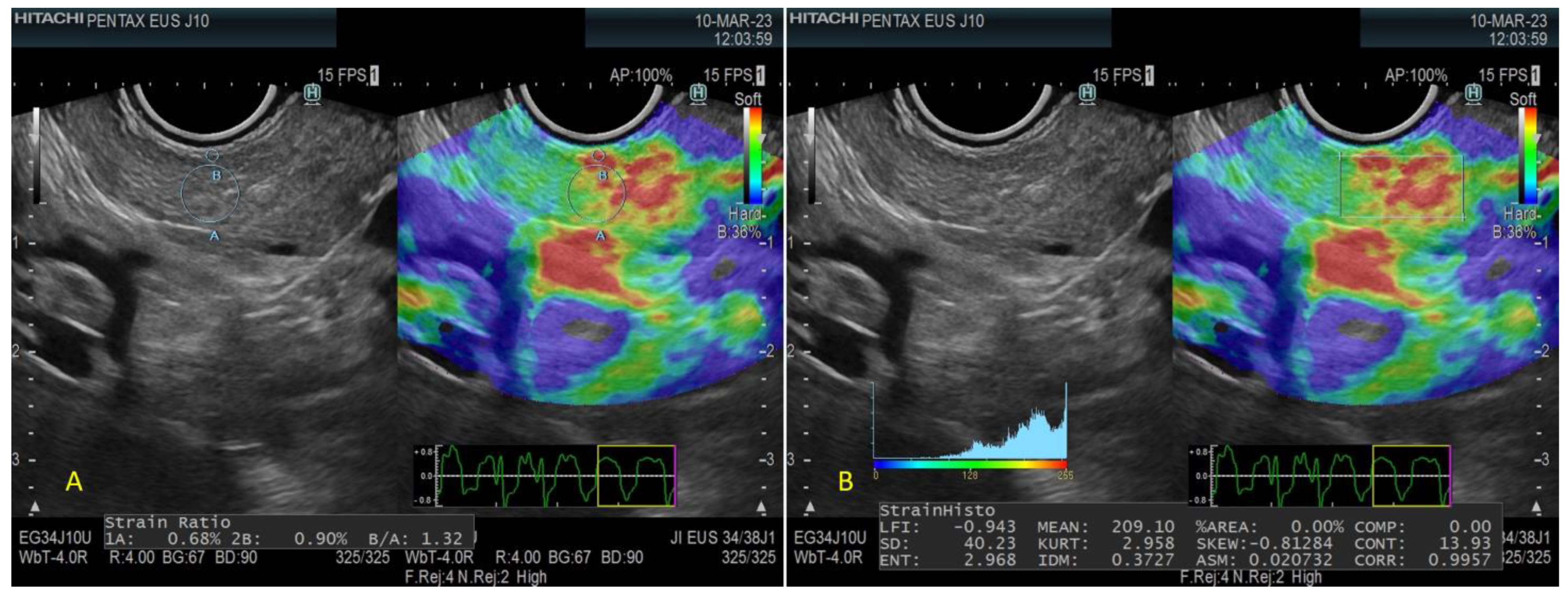 Diagnostics 13 01686 g002