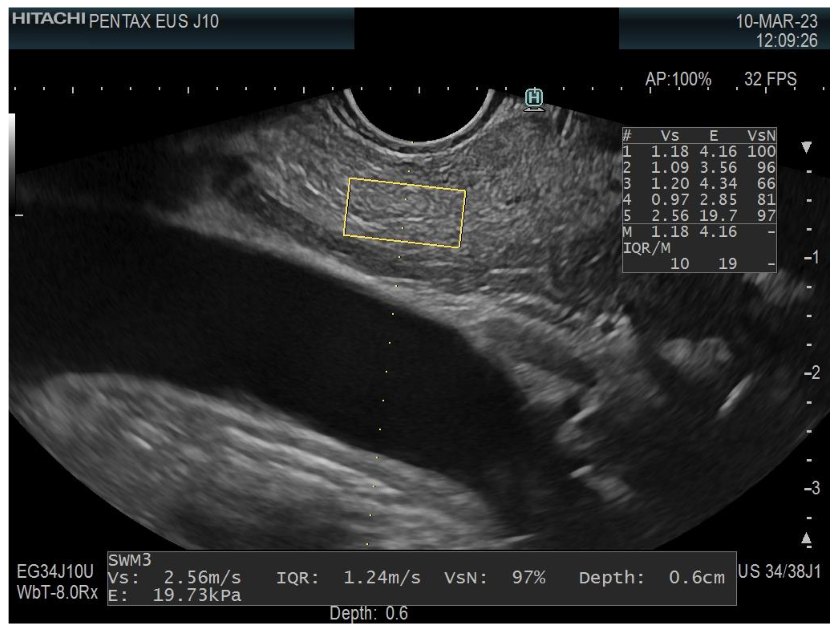 Diagnostics 13 01686 g003