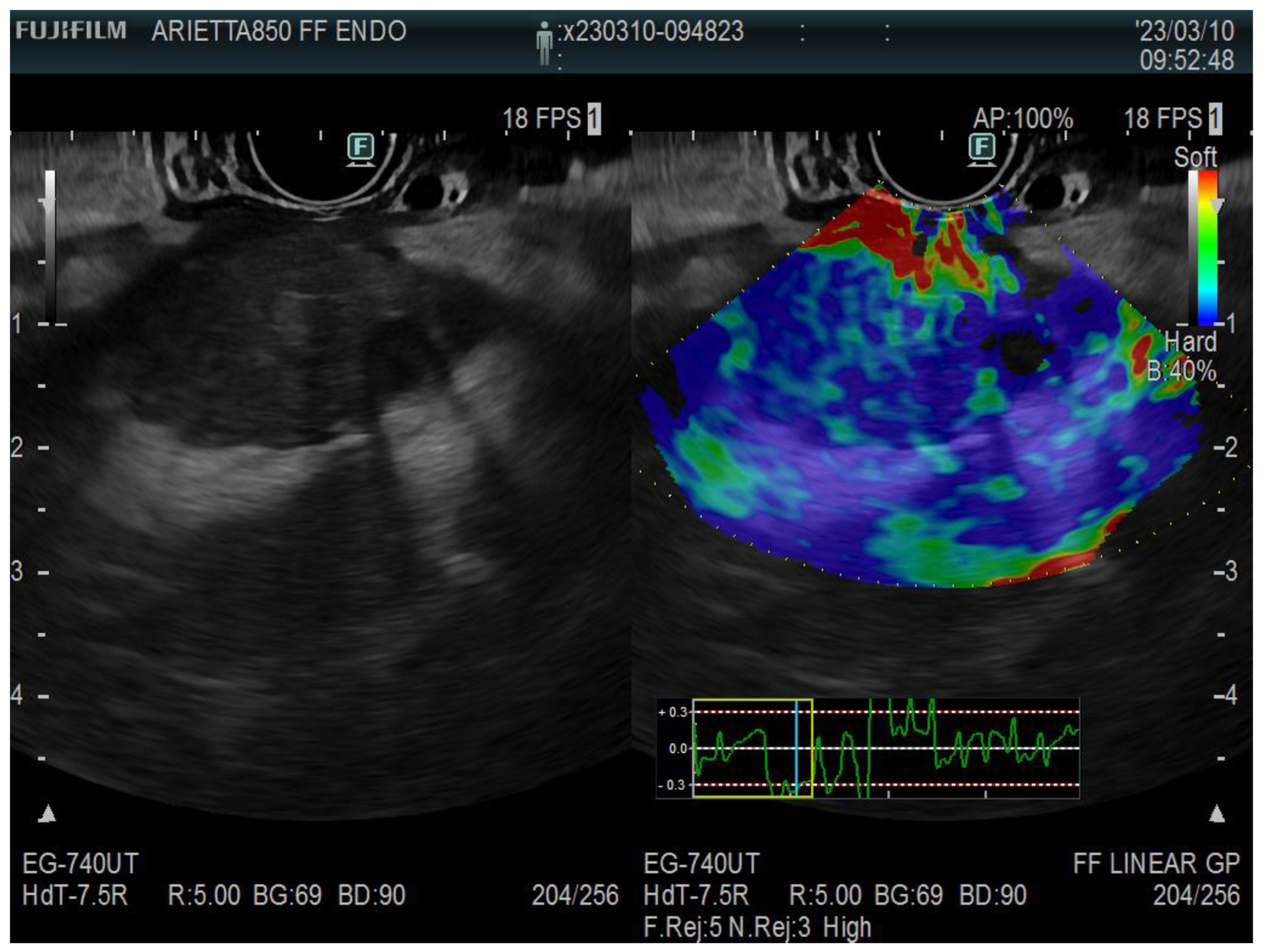 Diagnostics 13 01686 g004