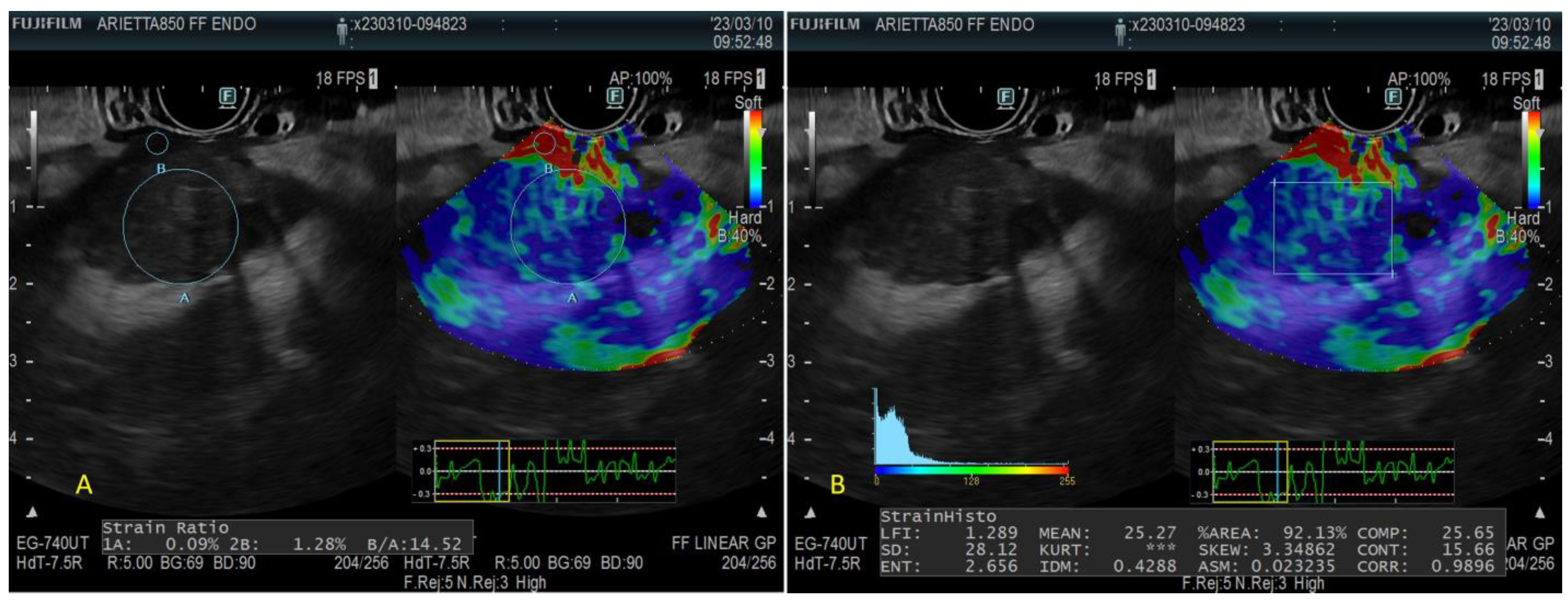 Diagnostics 13 01686 g005