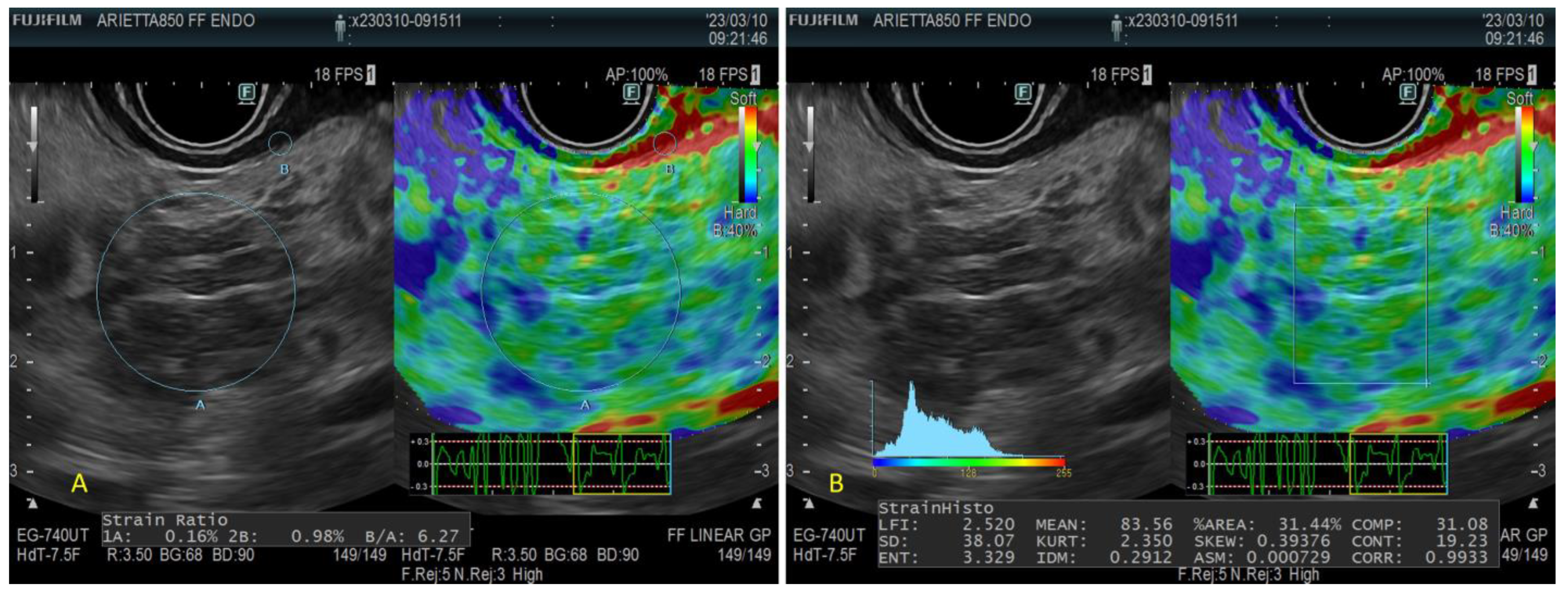 Diagnostics 13 01686 g007